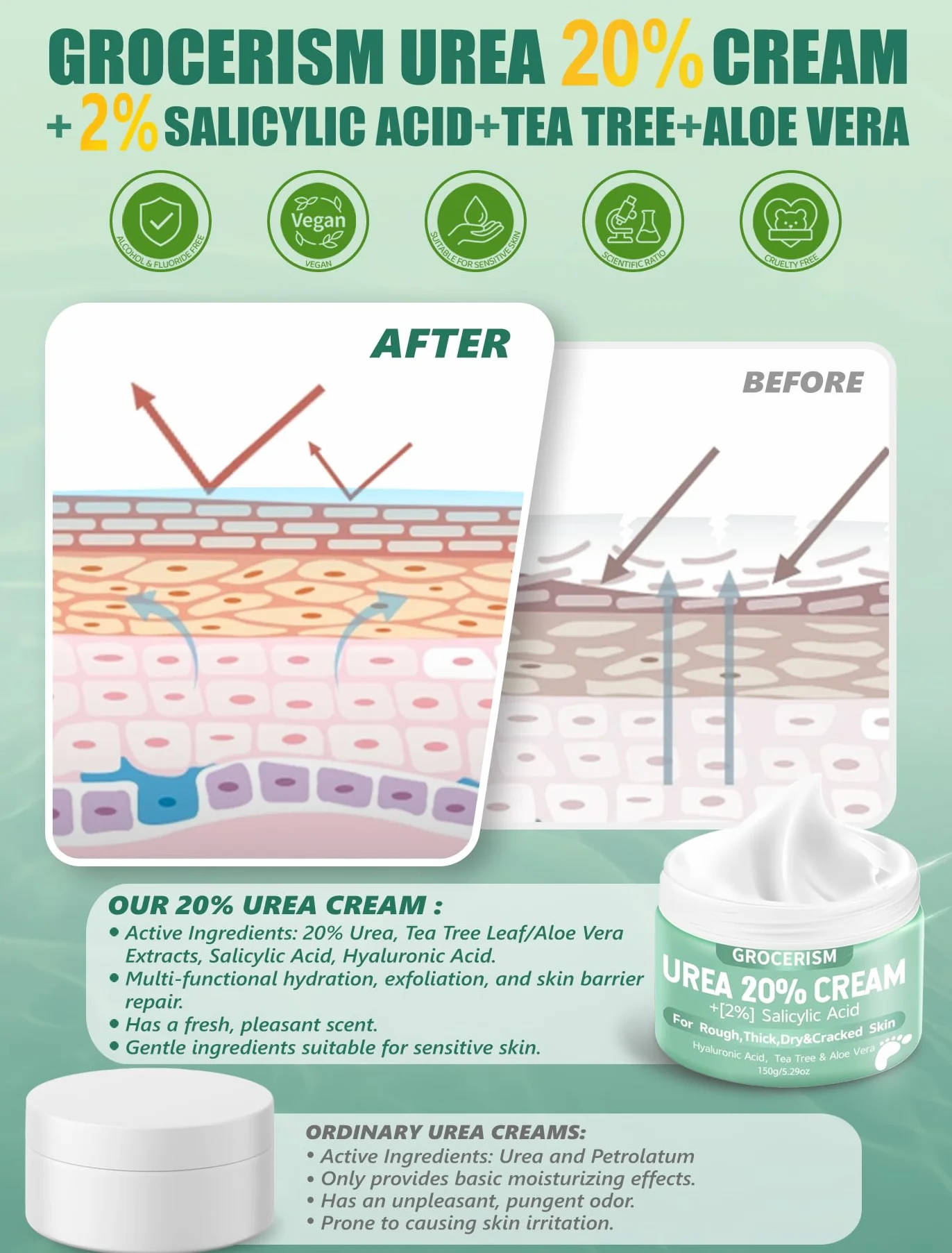 Crema Piedi Urea 20% 150g || Crema Piedi e Mani Con Acido Ialuronico, Tea Tree, Aloe Vera – Idratazione Profonda, Calli-20% 150g