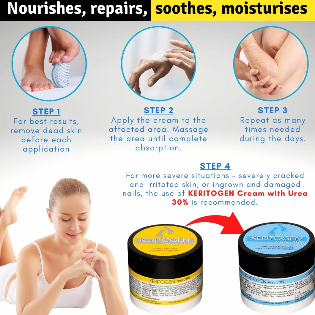 Crema Urea 20%, Eczemi, Cheratosi, Psoriasi, Eruzioni Cutanee, Riduce il Prurito, Sechezza, Pelle Secca e Screpolata, Calli, Duroni, Desquamazioni,- Cocos e Olio d'Oliva, 50g