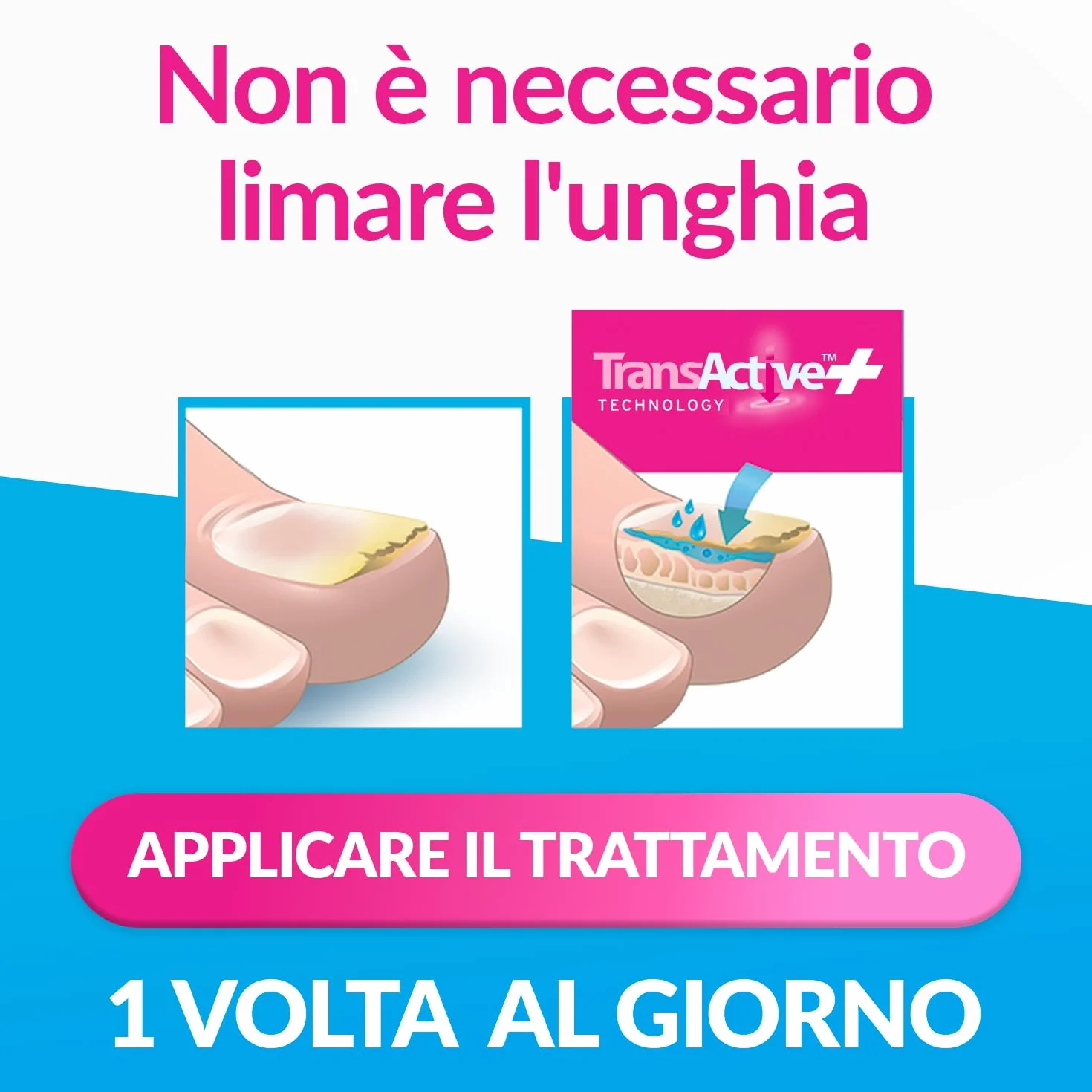 Excilor Micosi dell’unghia Forte, Trattamento Micosi Unghia Attivo, 30 ml