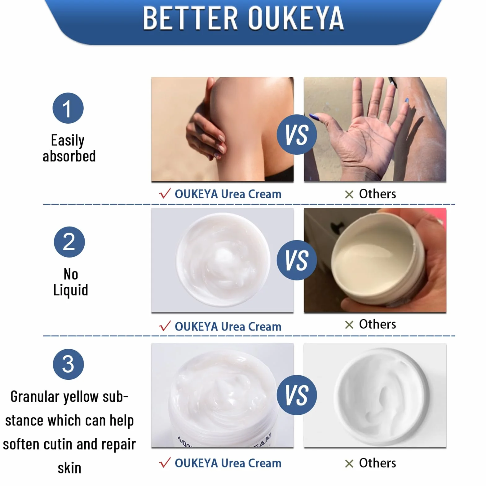 OUKEYA Crema all'Urea al 40% per Piedi Secca e Screpolata, Lozione Massima Forza 150 g