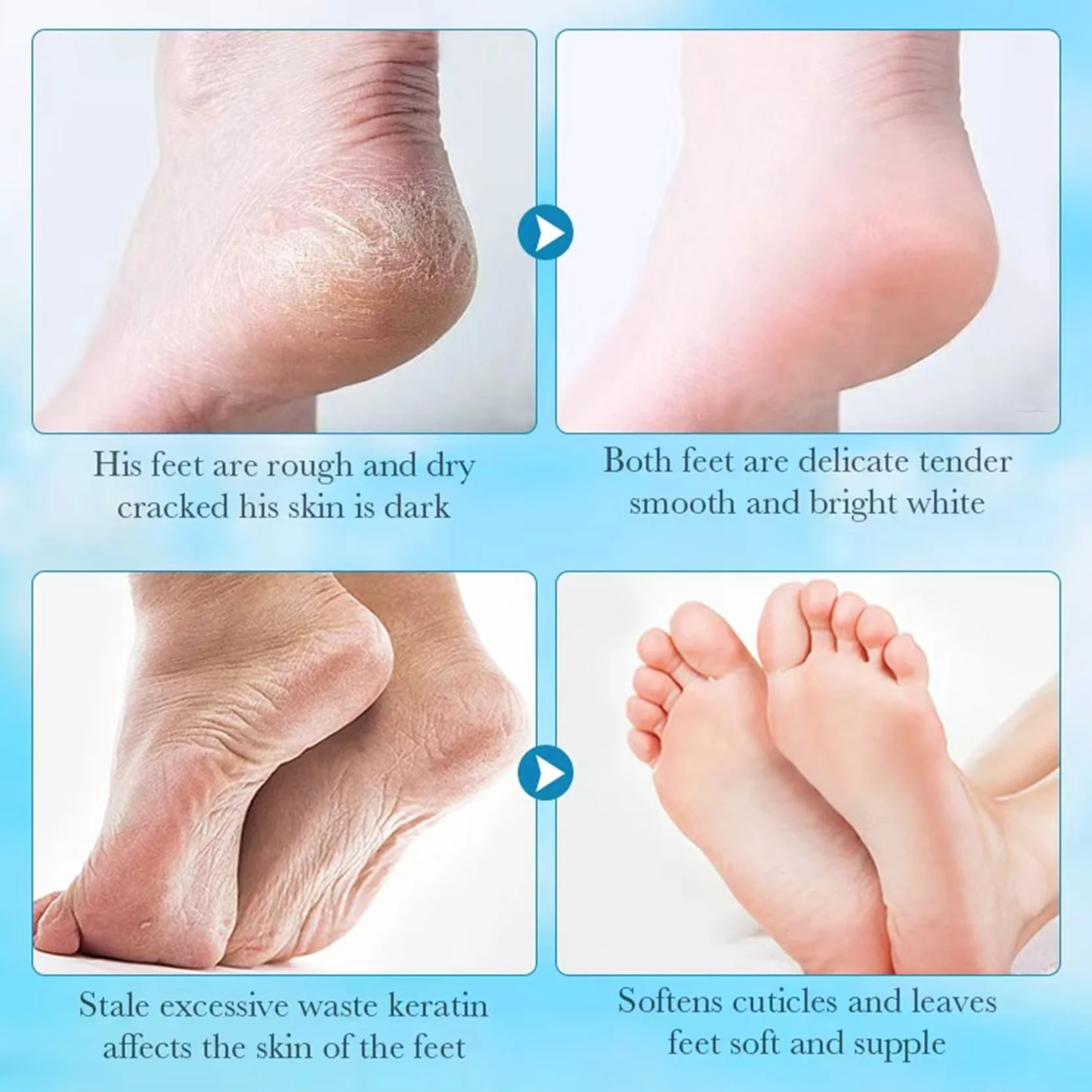 4 Paia Maschera Piedi Esfoliante,Trattamento Peeling Intenso,Peeling Delicato,Maschera Piedi per Pelle Secca e Talloni Screpolati, Cura Piedi Donna e Uomo