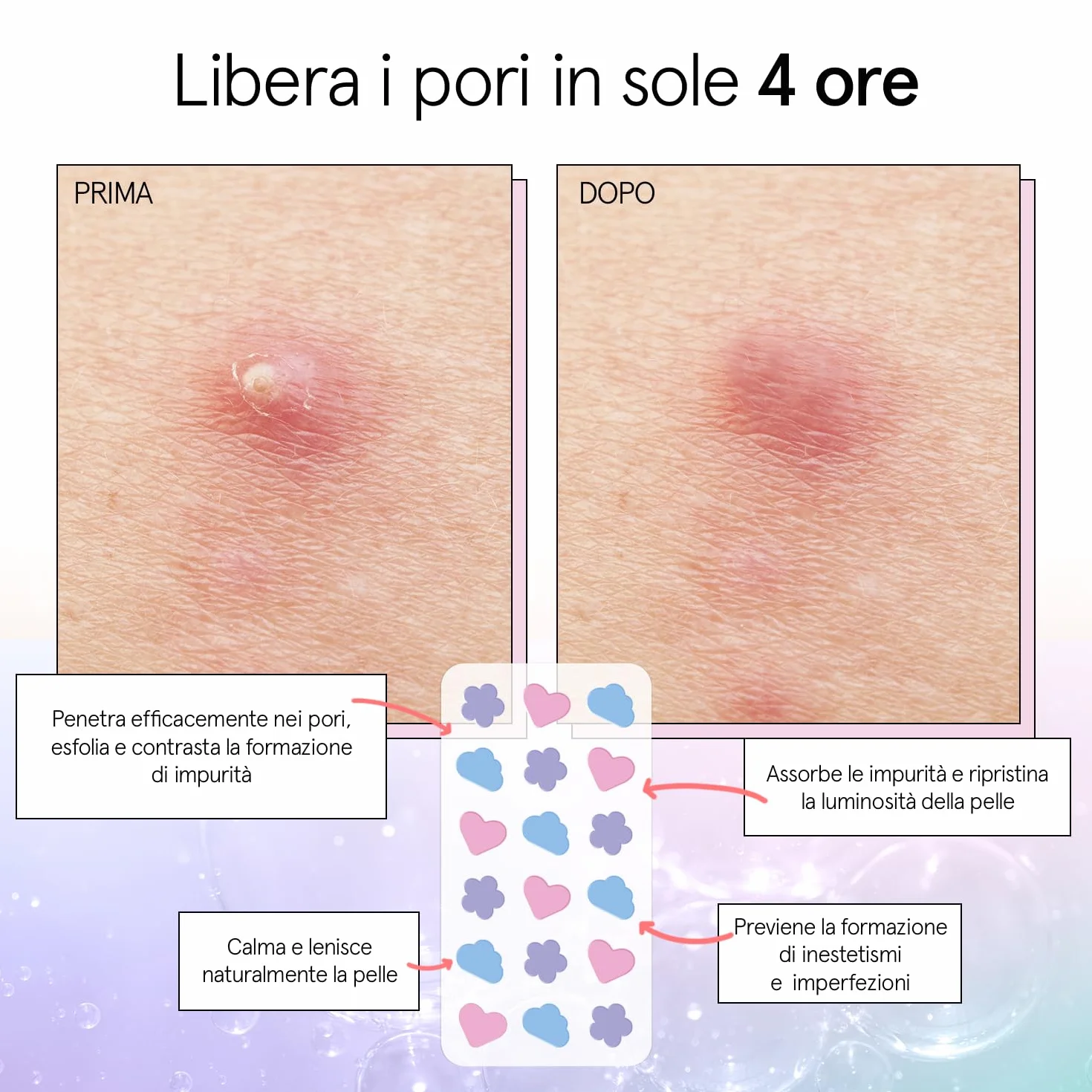 grace & stella Cerotti Idrocolloidali e Anti Imperfezioni Viso - Hydrocolloid Patch Dermatologicamente Testati, Vegan, Cruelty-Free [Misti, 72 Pezzi]