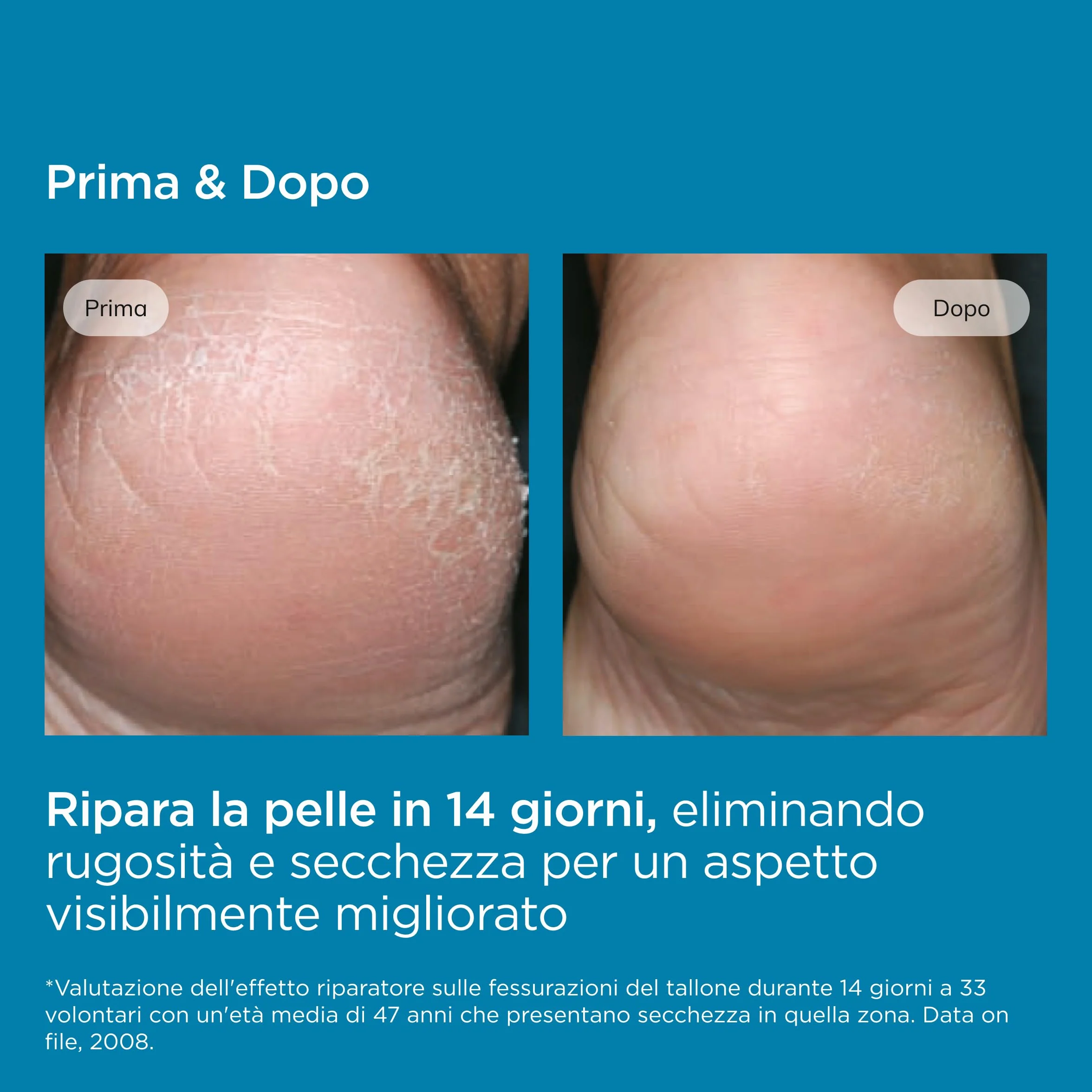 ISDIN Ureadin Podos 75 ml Gel Olio Idratante 10% Urea Ripara Piedi Secchi Screpolati