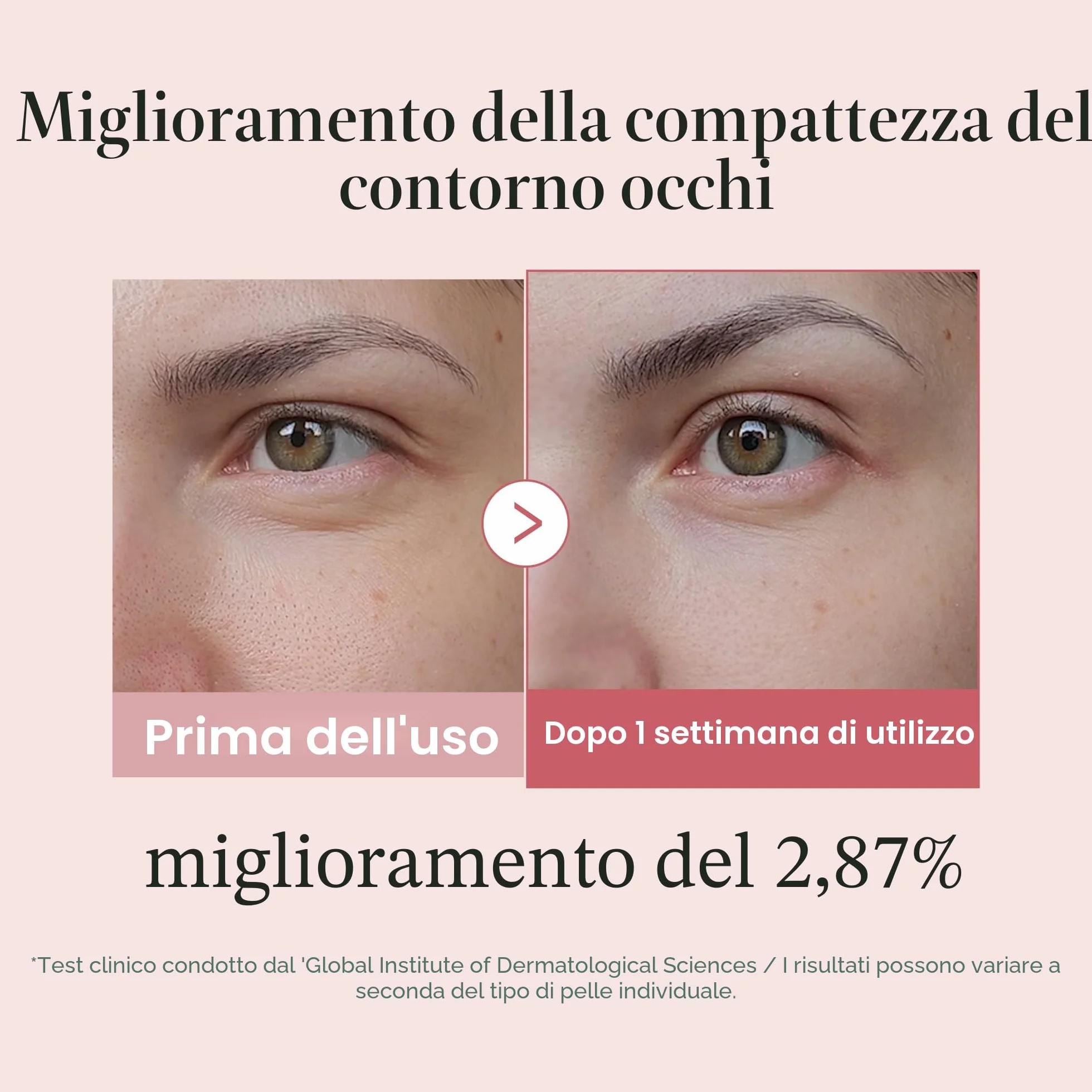 medicube Salmon DNA PDRN Pink Peptide Eye Serum 1,01 fl.oz – Siero occhi con Niacinamide e Retinolo puro per linee sottili e tono irregolare