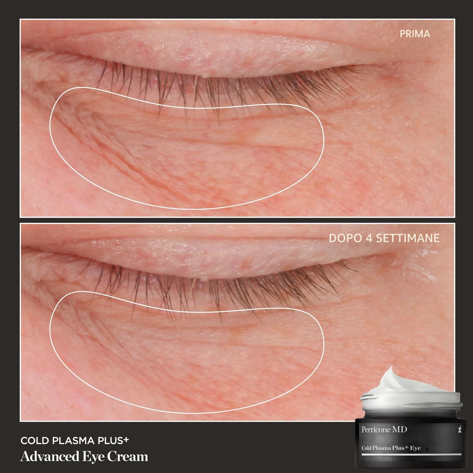 Perricone MD Advanced Cold Plasma Plus+ Eye Cream 15ml | Advanced skincare targeting visible signs of ageing, including texture, tone and firmness.
