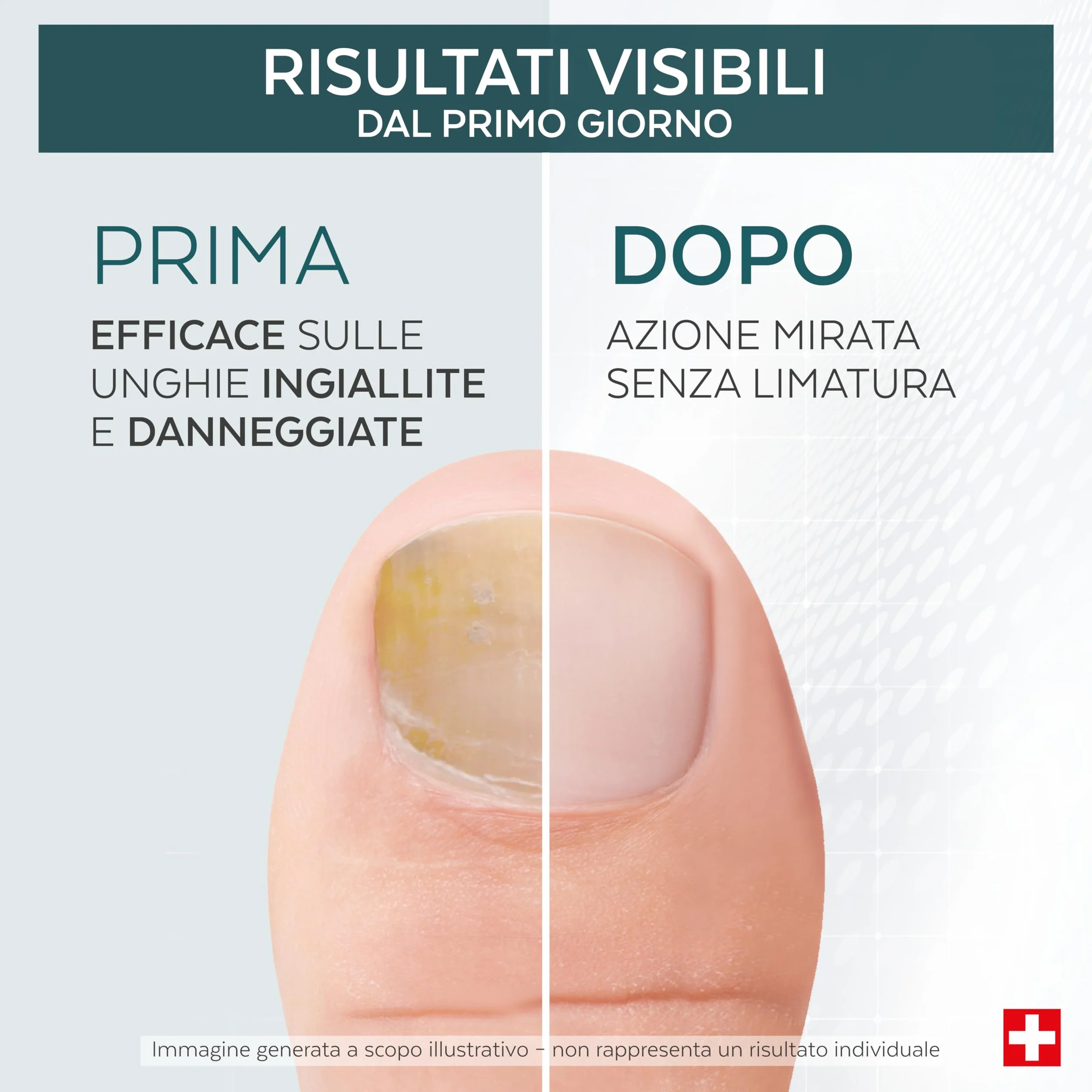 PODERM Tea Tree Riparatore Unghie 6 ml Siero 4-in-1 Swiss Made