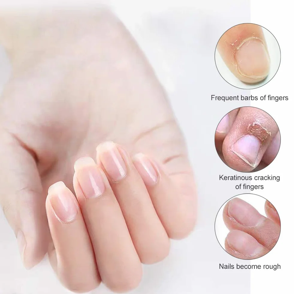 Trattamento Cuticole, Olio per cuticole, Siero trattamento unghie, Olio per cuticole penna Trattamento Olio per Cuticole Riparare la Cuticola Incrinata e Secca, 4 Pezzi