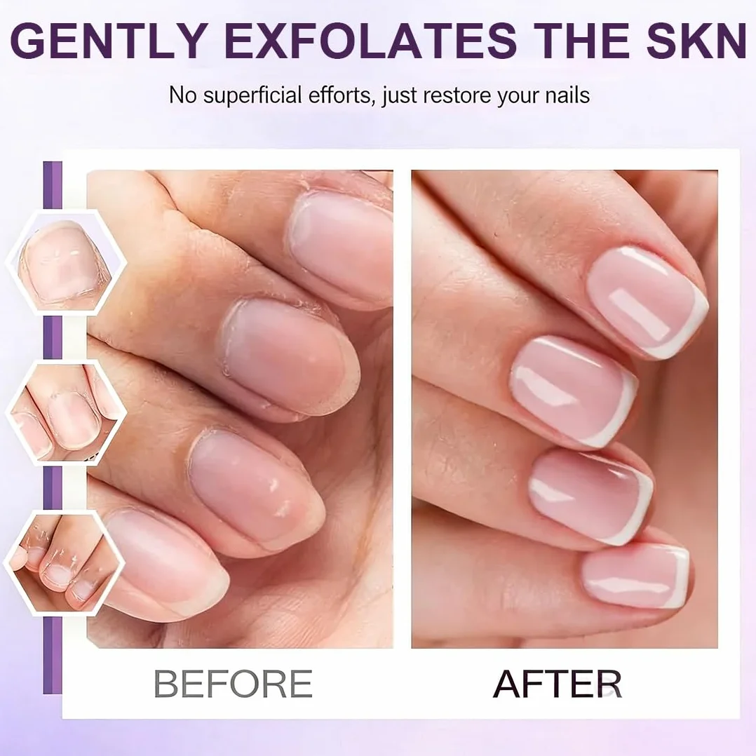 3 Pezzi Olio Cuticole Unghie, Penna per Olio Set di Oli per Cuticole, Trattamento delle Unghie, Nail Moisturizer, Nail Care Pen Formula Non Grassa