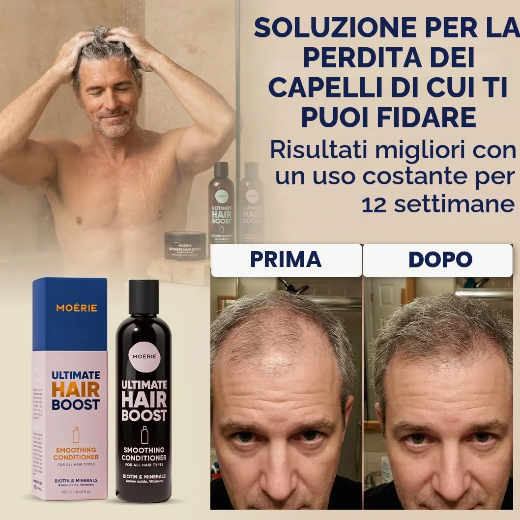 Moerie Balsamo Anti-Caduta Per Capelli Donna E Uomo, Più Lunghi E Pieni, Volumizzante, Vegan Friendly, Senza Parabeni E Silicone, Per Tutti I Capelli, Contro La Caduta Dei Capelli (250 Ml)x2