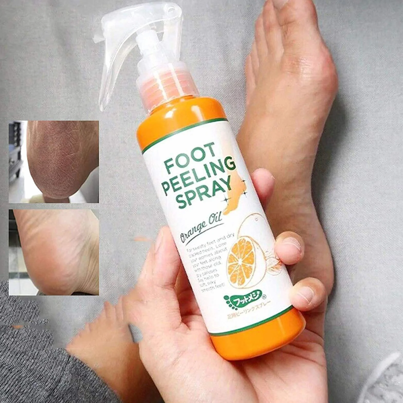 Foot Peeling Spray Orange Oil, Foot Peeling Spray That Remove Dead Skin, Hydrating Nourish Peel Off Spray, Remove Dead Skin within Seconds, Exfoliating Peeling & Calluses on Feet