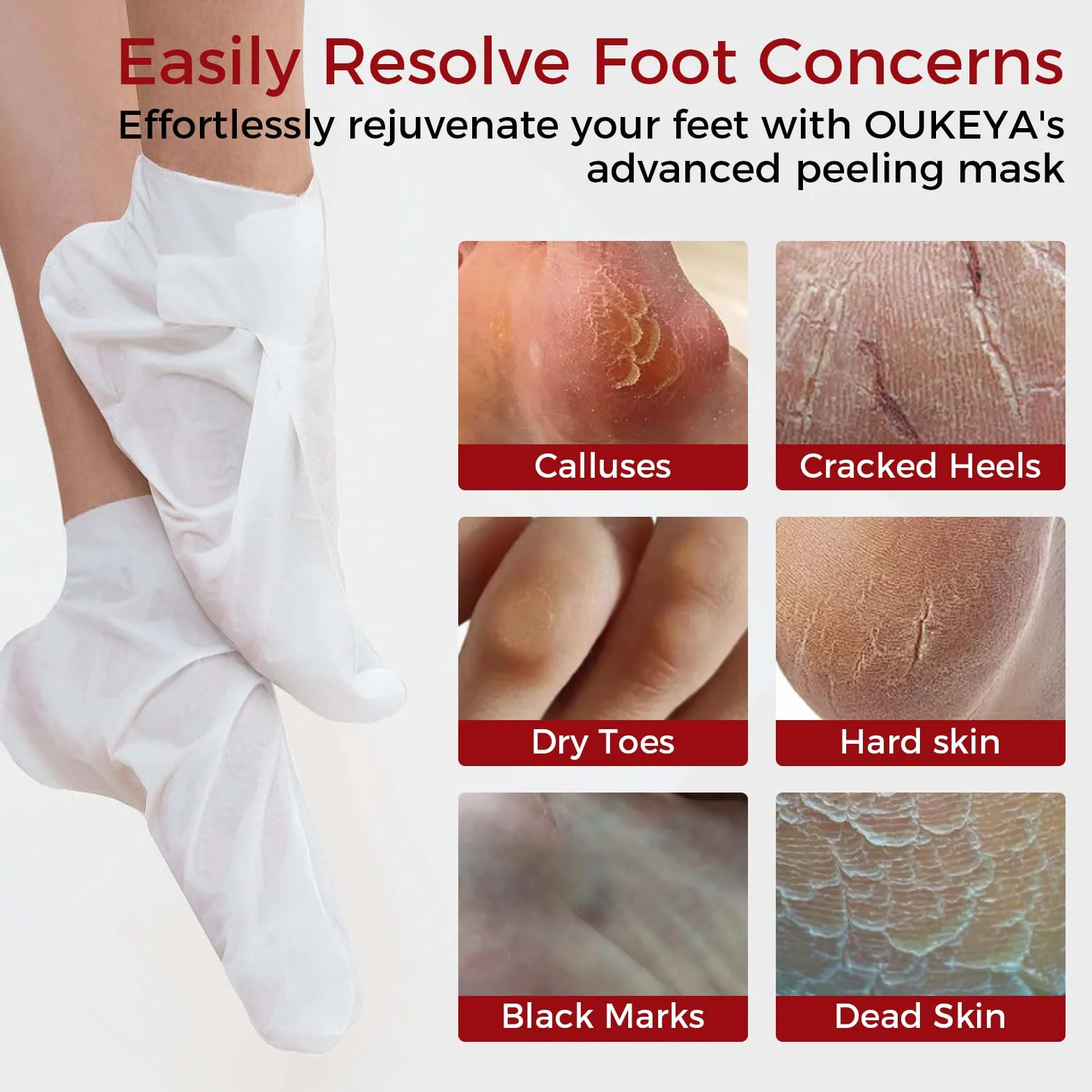 Maschera per Piedi 3 Paia, Trattamento Nutriente per Piedi, Ripara Talloni e Ammorbidisce Pelle Morta Secca, Foot Mask, Senza Peeling(Rose)