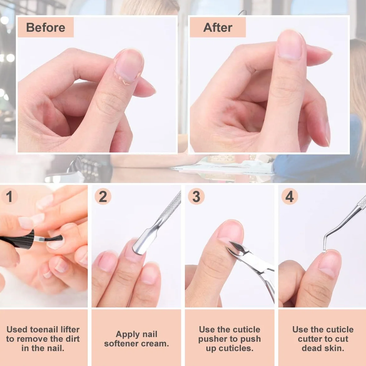 ACWOO Tronchesi per Cuticole 4 Pezzi, Taglia Cuticole Professionale Acciaio Inox per Unghie Incarnite, Kit Manicure con Spingi Cuticole