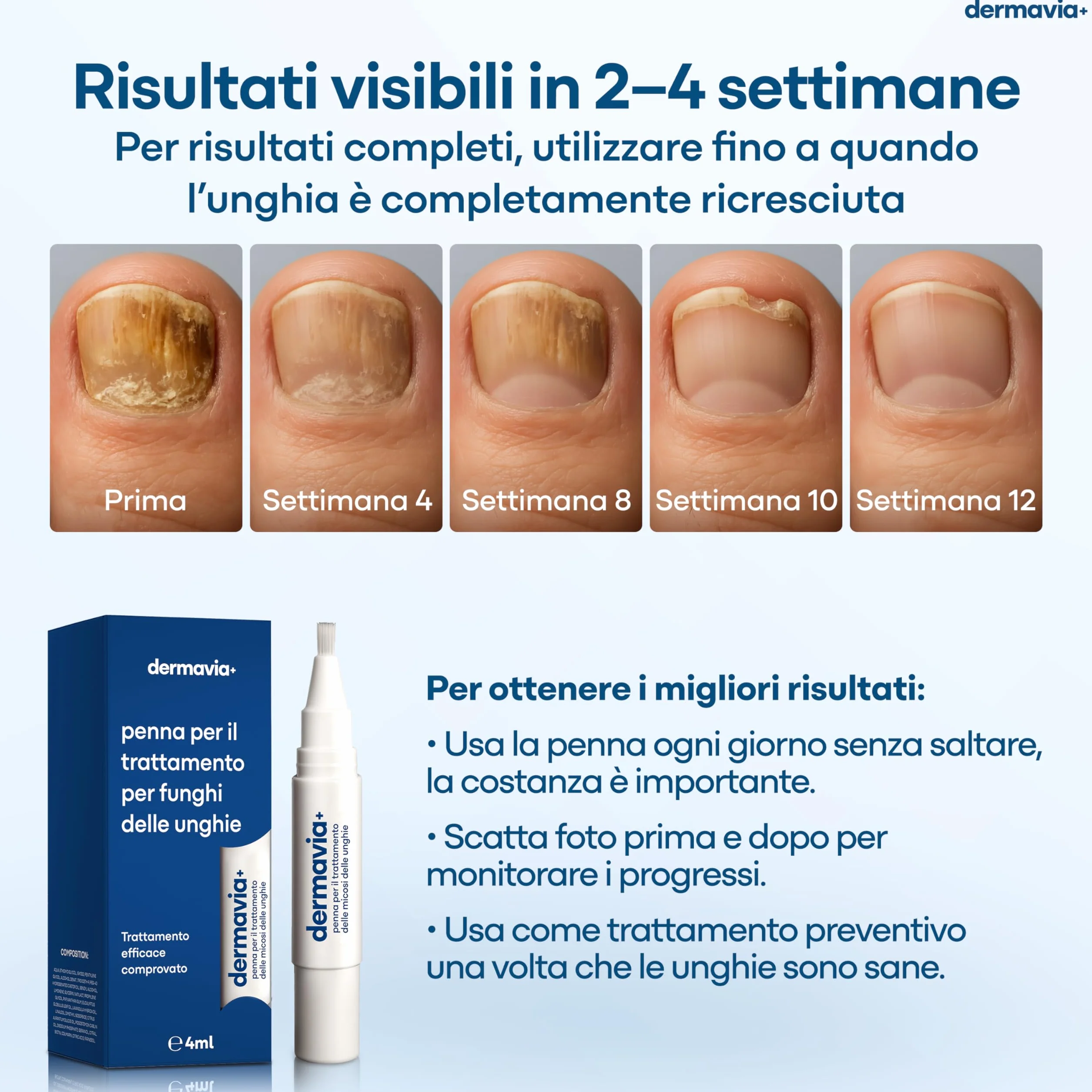 Trattamento per Funghi delle Unghie 4 ml Penna a Torsione per Piede d'Atleta