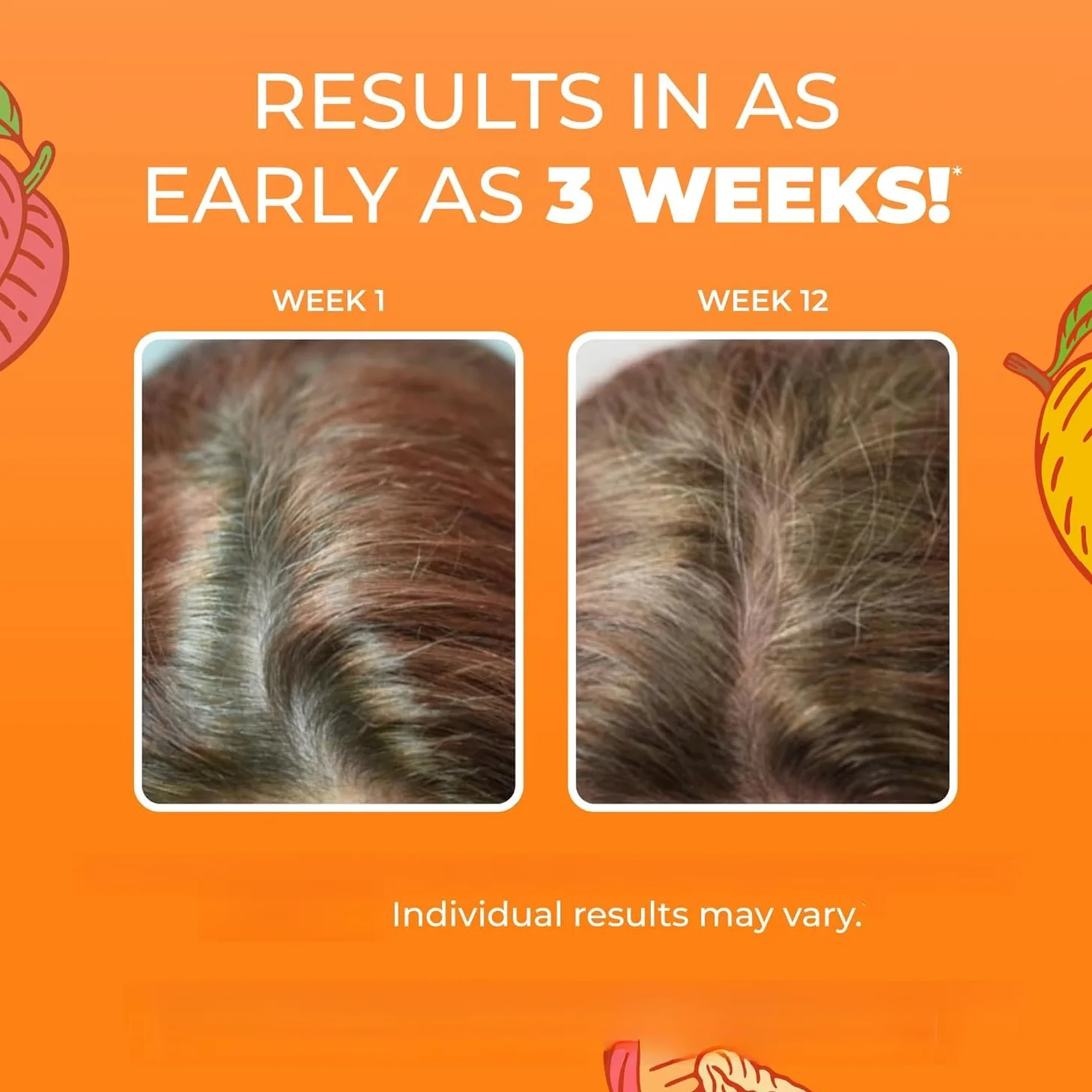 vitamine per la crescita dei capelli | Aiuta a far crescere capelli e unghie naturalmente più forti; aiuta a migliorare le condizioni della pelle