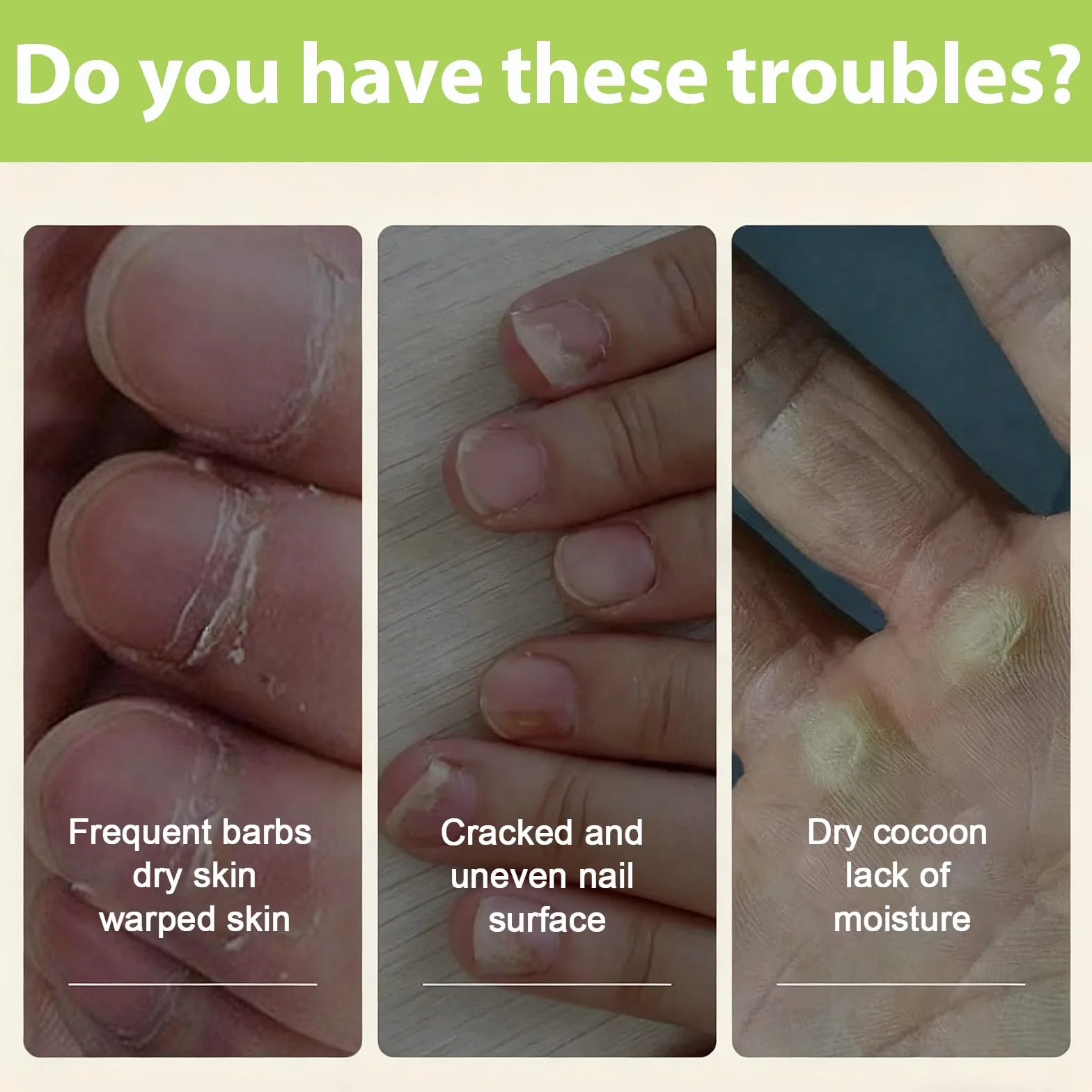 20ml Olio per Unghie e Cuticole,Cura Delle Unghie Olio,riparazione per unghie Fragili olio,Nutre,Rafforza e Idrata le Cuticole e Unghie,Cura per Mani e unghie