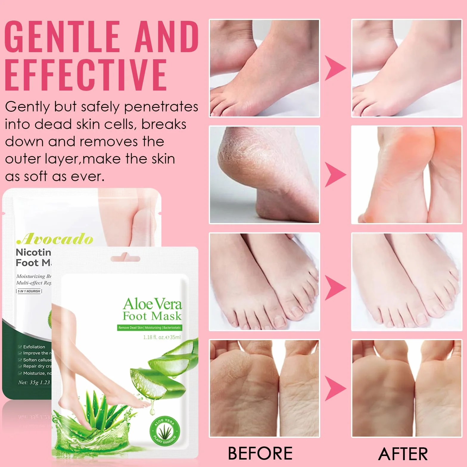 2 Paia Maschera Peeling Piedi, Maschera Esfoliante Piedi, Pedimask Nutriente e Idratante, Riparazione Tallone Ruvido, Rimozione di Calli e Pelle Morta Piedi (Aloe Vera + Avocado)