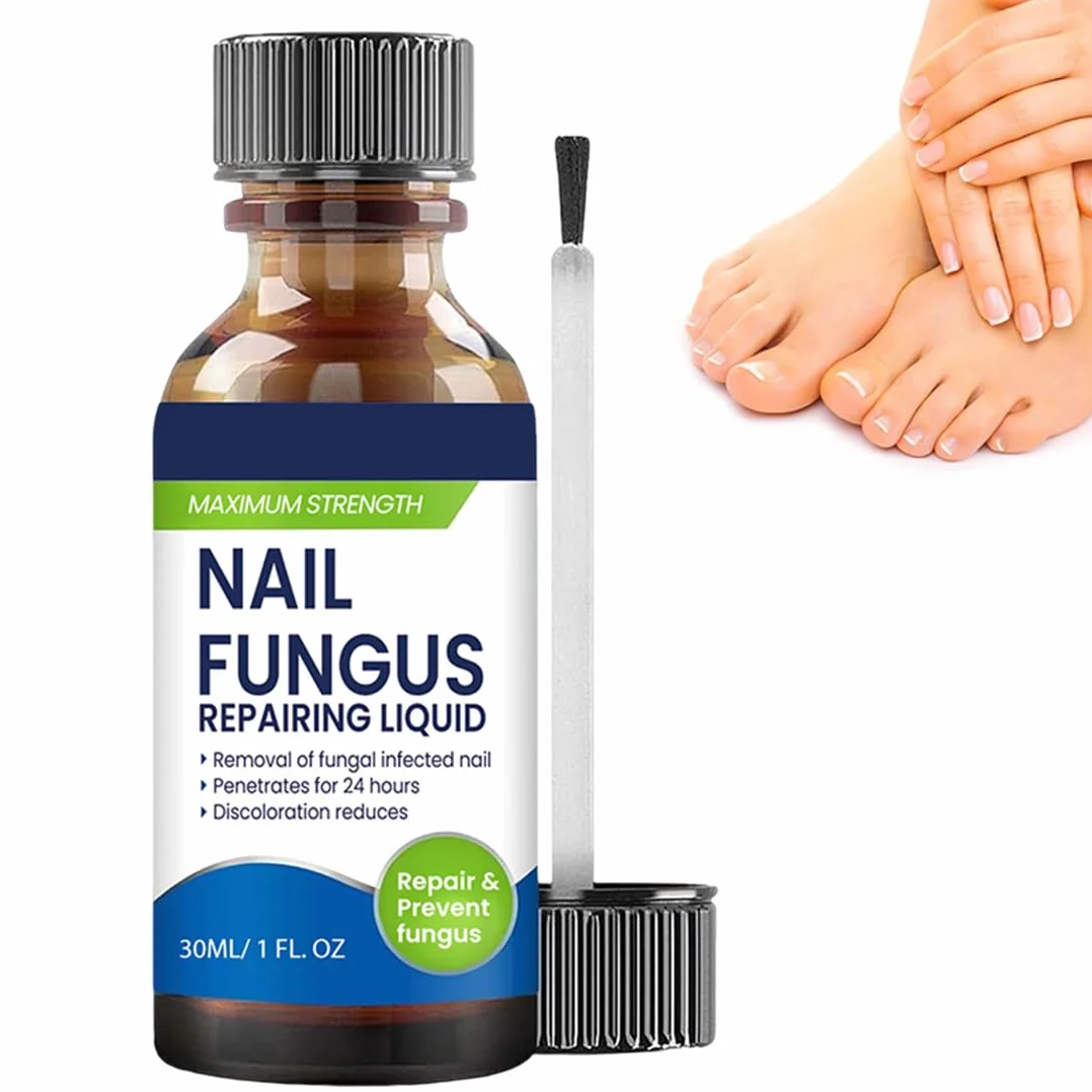 1 Pezzi Smalto Micosi Unghie Piedi con Formula Antimicotica Altamente Efficace, Previene la Recidiva di Funghi Unghie Piedi e Onicomicosi Unghie Piedi, Ideale per Micosi Unghie Piede Forte,B