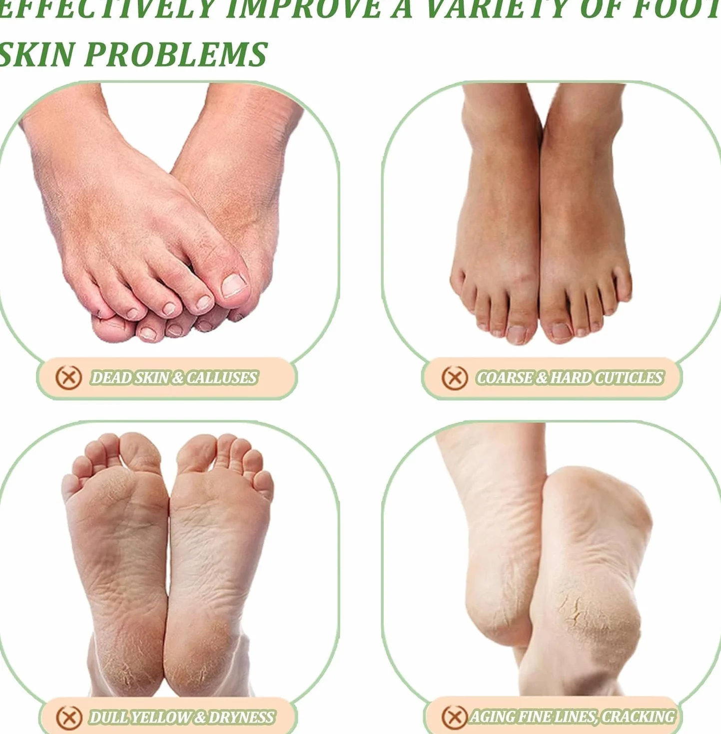 Maschera per piedi, 3 paia di calzini per calli, maschera esfoliante efficace per la cura dei piedi, calzini per la rimozione della calli e della pelle morta, maschera esfoliante per uomini e donne