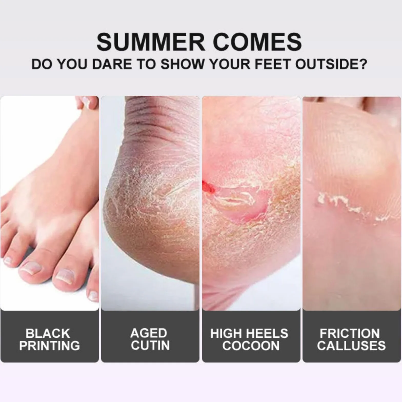 Joyeee Maschera Piedi Esfoliante, Lavender Foot Peel Mask, Efficace Peeling Piedi, Scrub Piedi e rimozione Calli dei Piedi, per Uomini e Donne, 5 paia