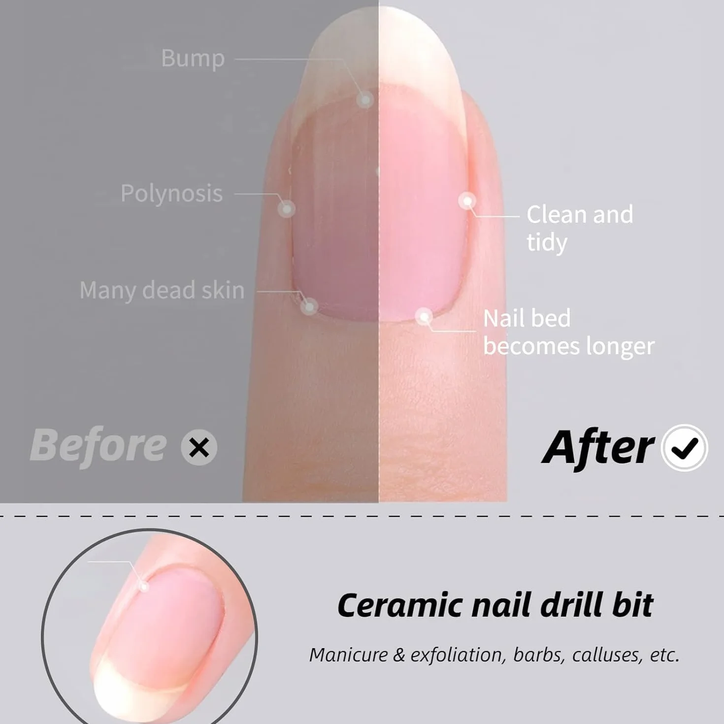 MEISO 5 Pezzi Punte Fresa Unghie Ceramica per Rimuovere Gel Acrilico Cuticola