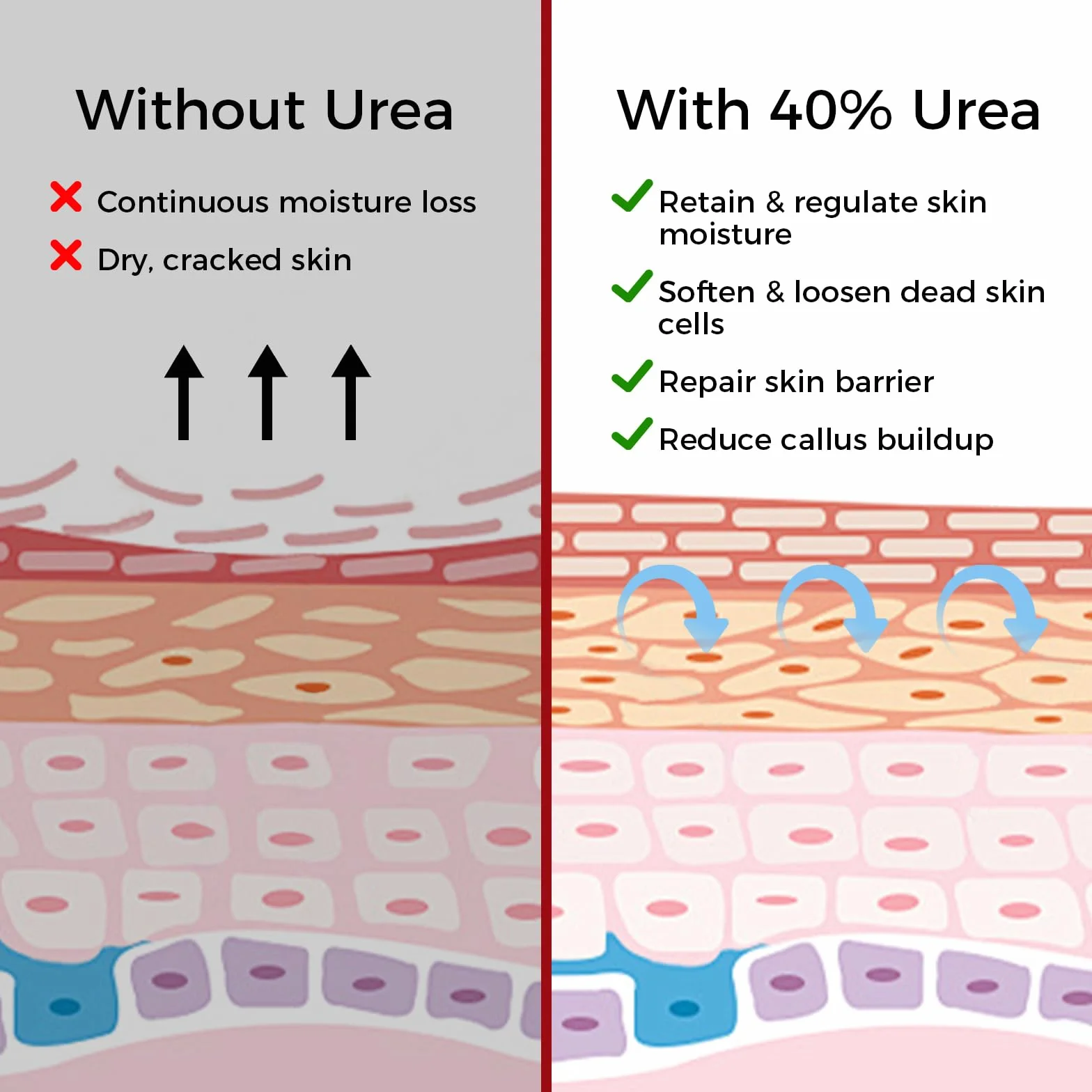 Maschera per Piedi 3 Paia, Trattamento Nutriente per Piedi, Ripara Talloni e Ammorbidisce Pelle Morta Secca, Foot Mask, Senza Peeling(Rose)
