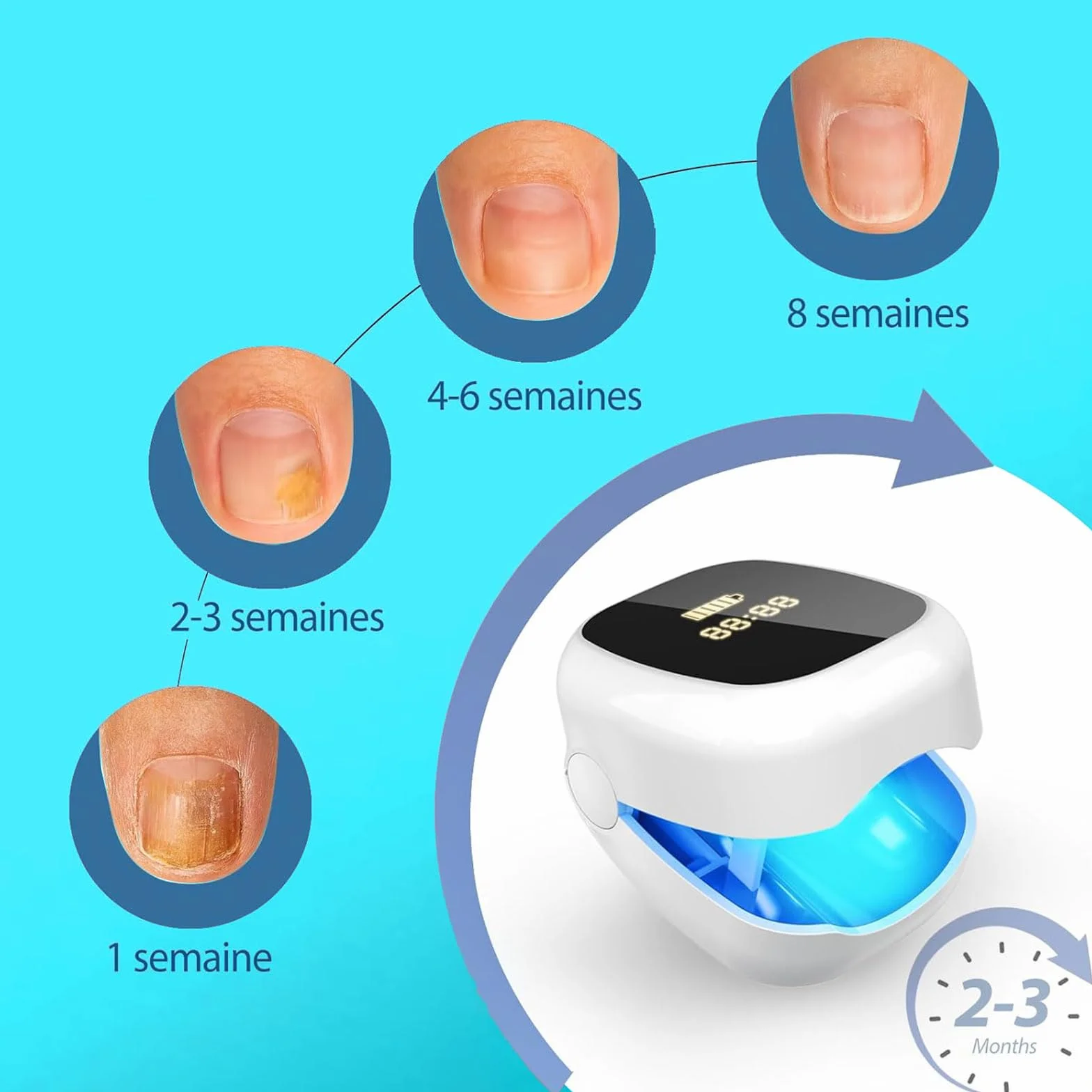 Dispositivo Anti Micosi Unghie Piedi, Dispositivo Laser per Micosi Unghie Dei, Laser Trattamento fungo chiodo, Micosi Unghie dei Piedi Pulizia e Riparazione Unghie Effettive per Micosi (Color 2)