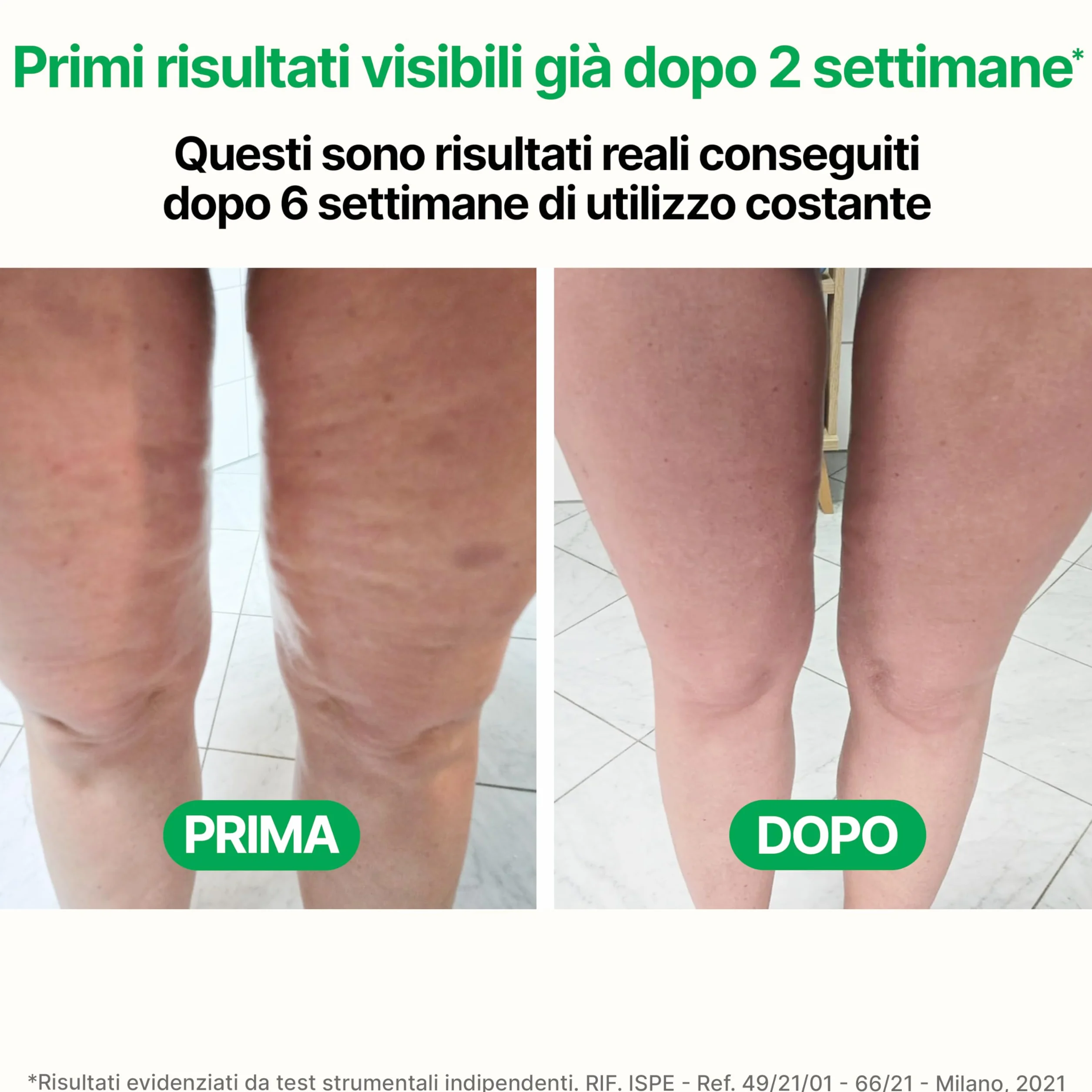 TESMED CELLULITE Massaggiatore Anticellulite Brevettato – Rassodante e Snellente per Gambe, Glutei e Cosce – Made in Italy