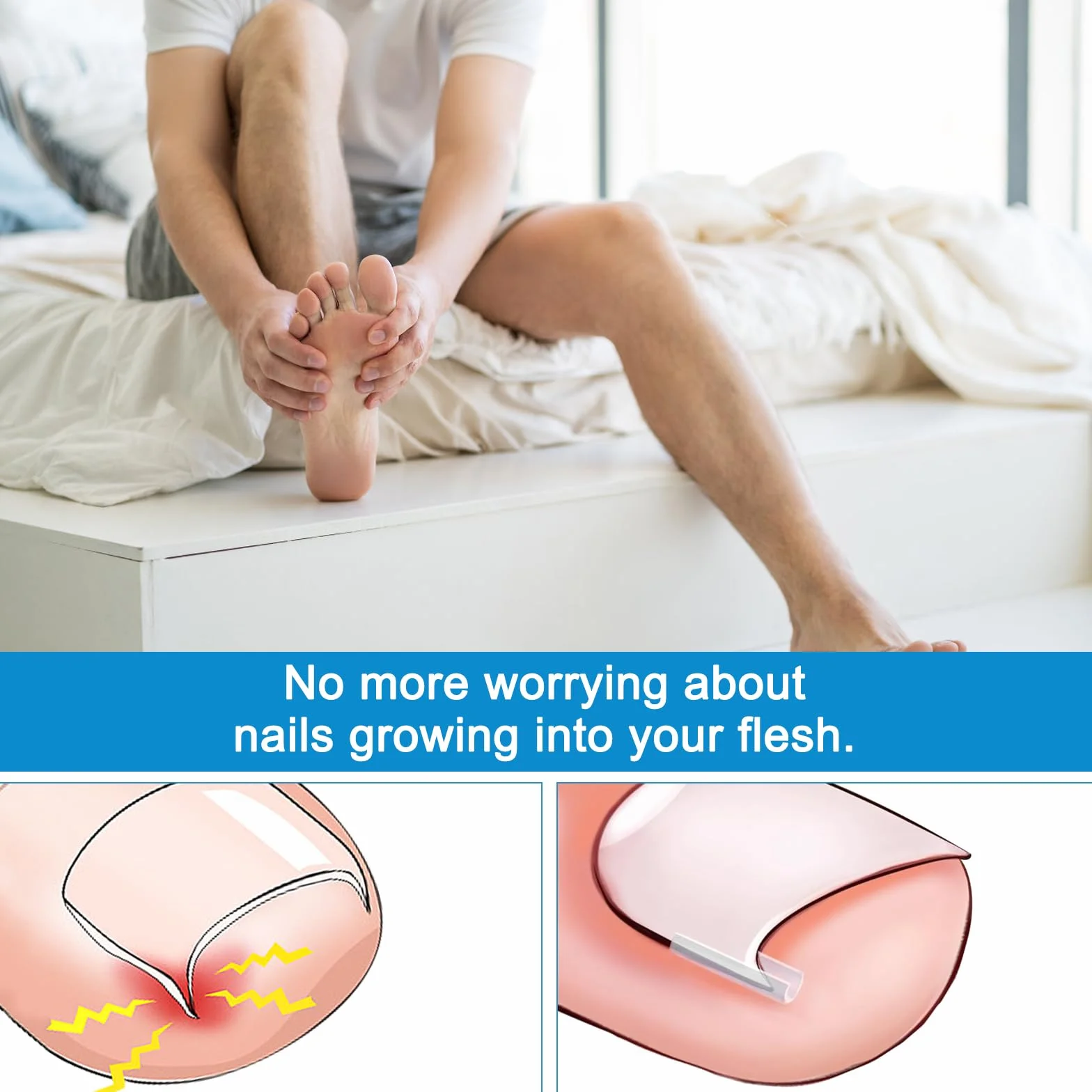 40 Pcs Unghie Incarnite Piedi Strisce Correttore Per Unghie Incarnite Unghie Piedi Incarnite Unghie Incarnite Piedi Unghie Incarnite Piedi Attrezzi Per Pedicure Con Sollevatore Per Unghie Incarnite