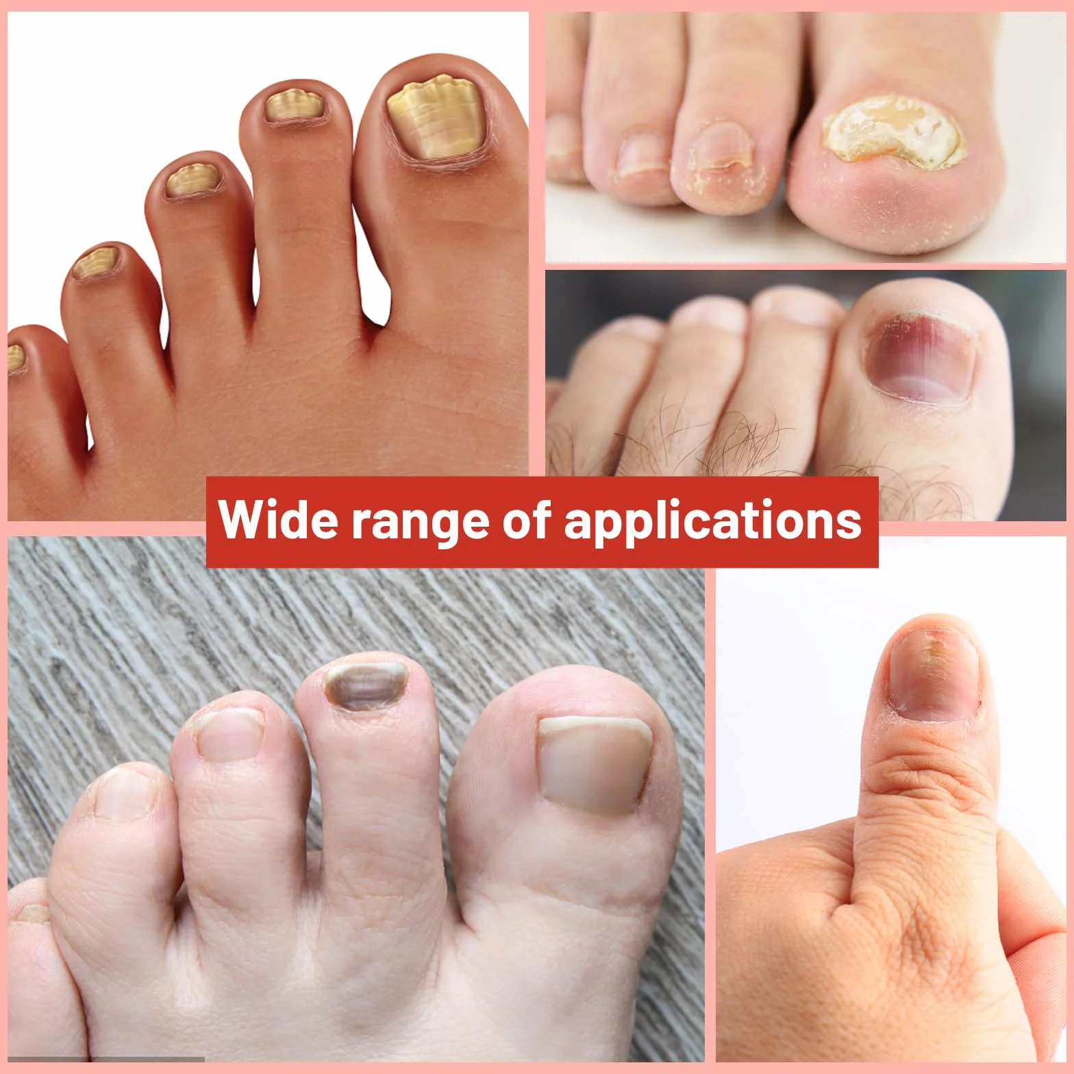 EIHI 42 Pezzi Fungal Nail Patches,Per Trattamento Fungine delle Unghie,Riparazione delle Unghie dei Piedi, Trattamento Antifungino per Unghie,Delicato e Idratante,Unisex（B）