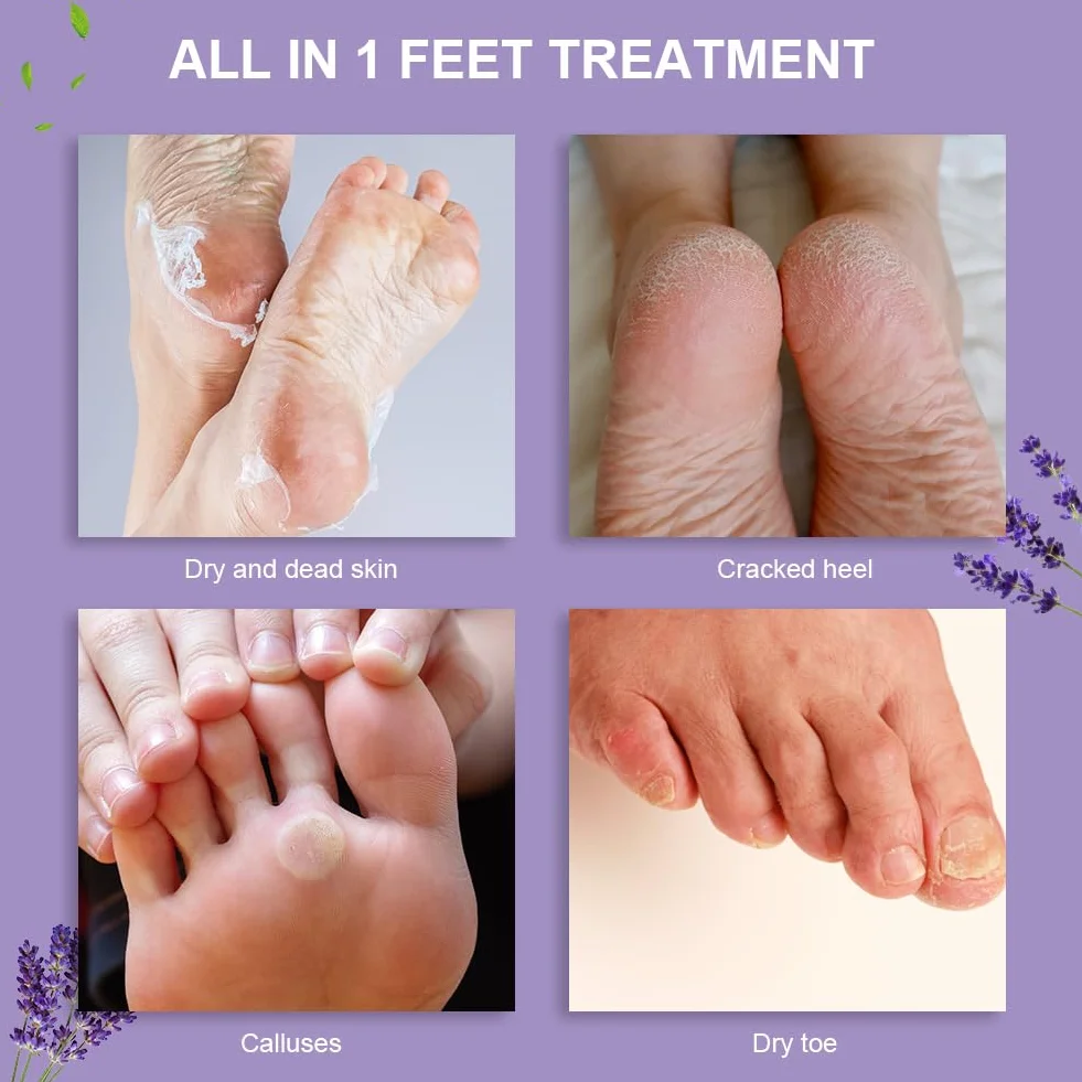 ACWOO Maschera Piedi Esfoliante, 4 paia Maschera Peeling Piedi， Maschera per Piedi Efficace Cura dei Piedi i Scrub Piedi, Maschera Esfoliante Rimozione calli e Pelle Morta piedi