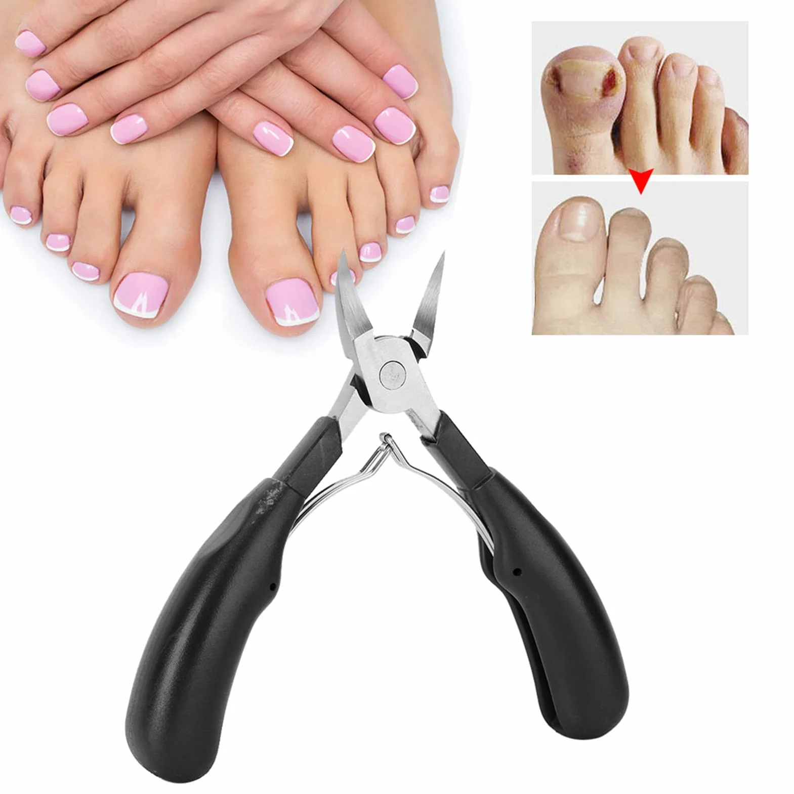 Pinza per Cuticole Professionale in Acciaio Inossidabile per Unghie Incarnite con Manico Ergonomico (BLACK)