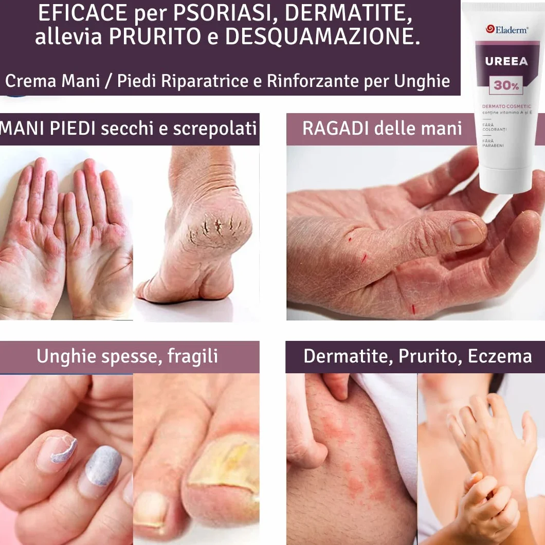 Crema Urea 30% 100ml per Eczemi Psoriasi Cheratosi Dermatite Talloni Screpolati Calli