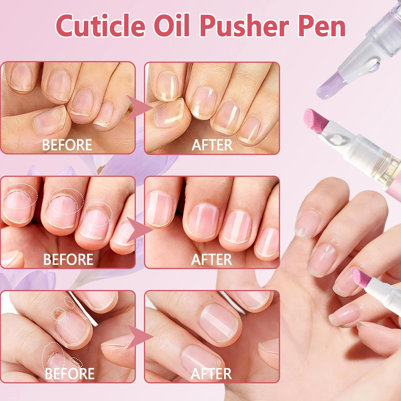 2PCS Penna Spingi Cuticole 2 in 1, Penna 3 in 1 con olio per cuticole, Olio Cuticole Unghie, 3-In-1Nail Care Pen, Nutriente E Lucidante,Cura Delicata,Adatto Per Unghie Secche E Danneggiate