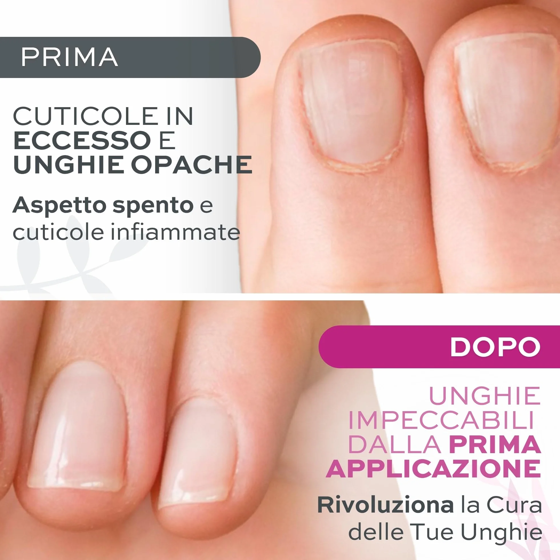 Rimuovi Cuticole Professionale 12 ml – Ammorbidisce e Rimuove Pellicine in 2-5 Minuti – Cuticle Remover Delicato e Profumato – Ideale per Manicure e Pedicure – Risultato Preciso e Unghie Curate
