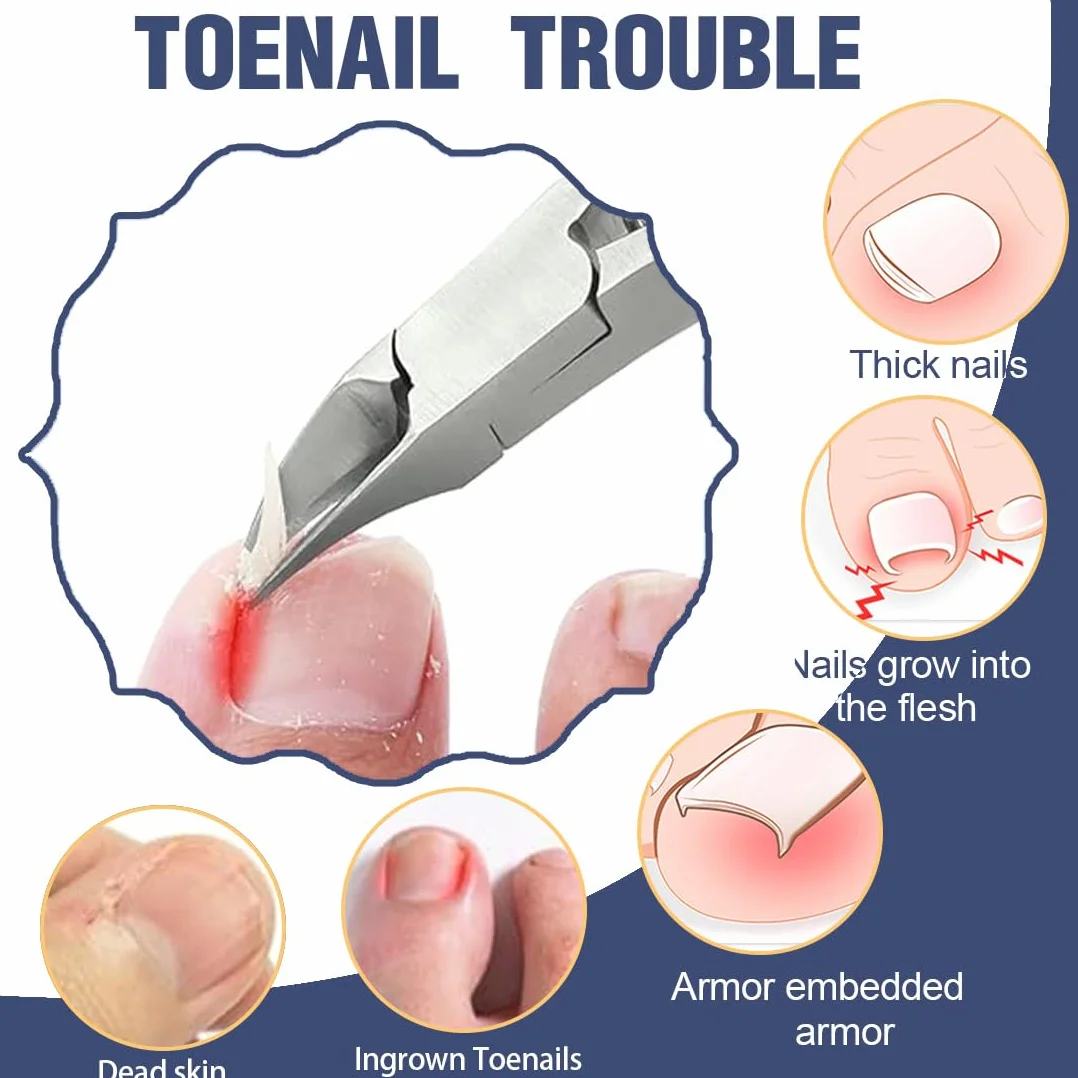Taglia Cuticole Professionale, Tronchese Per Unghie Spesse Incarnite con Spingi Cuticole,Tronchese Unghie, Tronchesino Tagliaunghie Professinale, per Unghie Spesse e Dure Pedicure e Manicure Strumenti