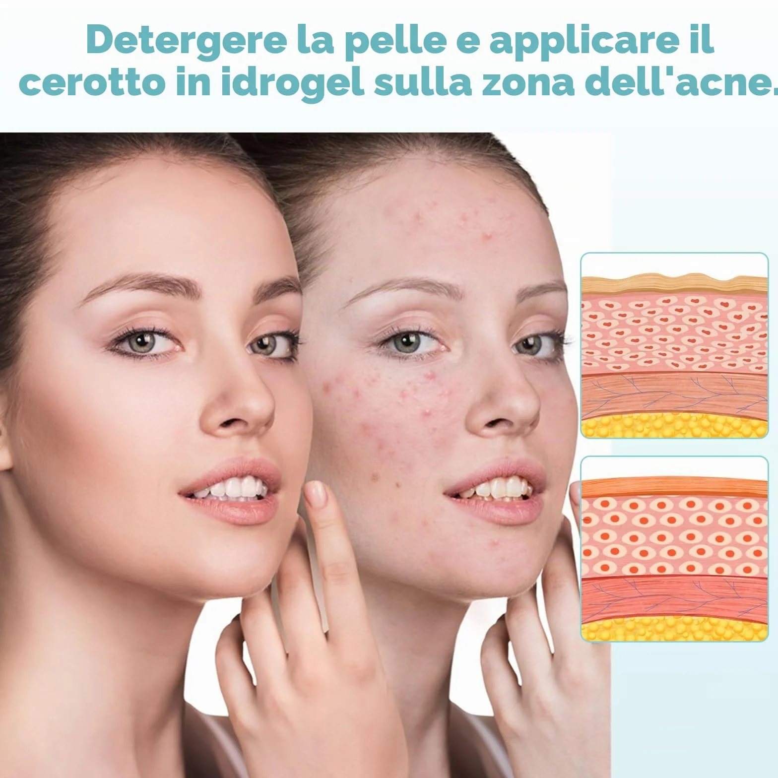 400 Pezzi pimple patch star, patch brufoli stelline Invisibile Naturale Hydrocolloid, cerotti per brufoli con olio dell'albero tè Acido Salicilico, acne patch Assorbenti Impermeabile e Traspirante