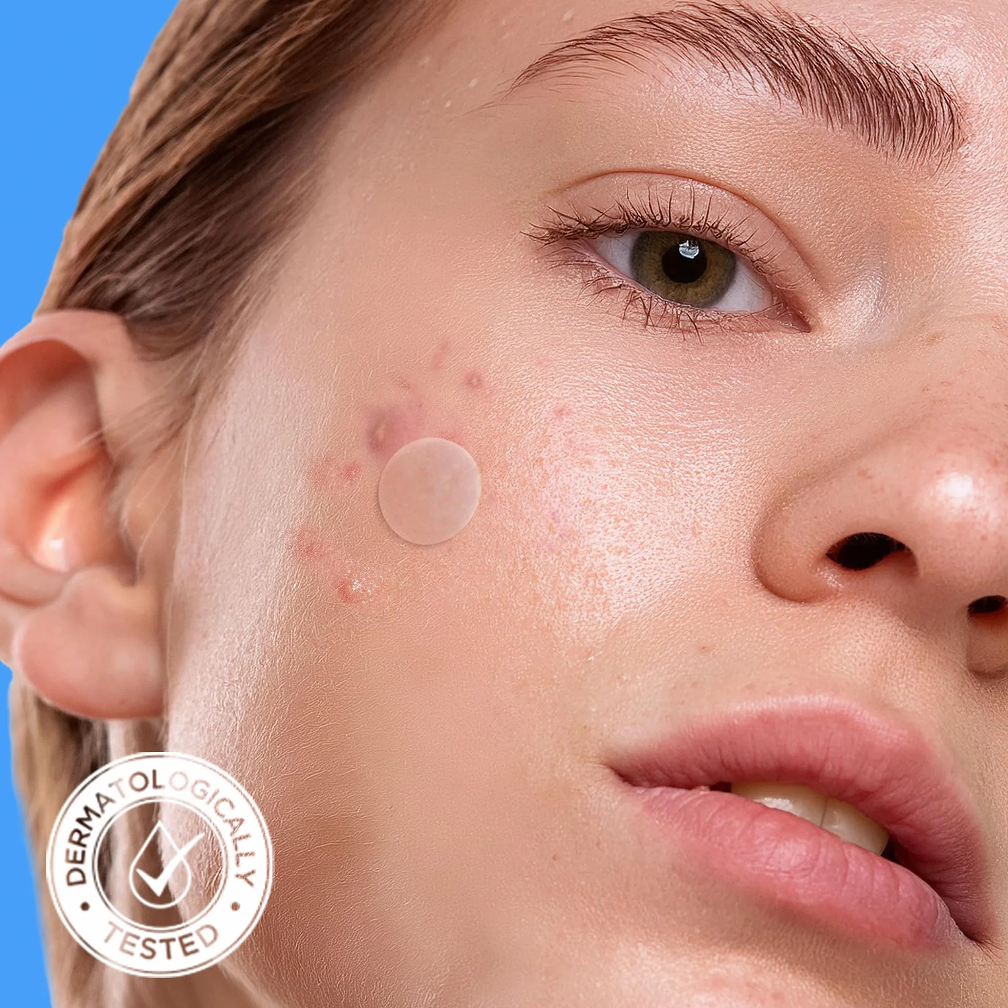 AVARELLE Pimple Patches: Cerotti brufoli viso Hydrocolloidali con Olio di Tea Tree, Anti-acne, Vegan e Cruelty-free, ideali per trattamento mirato di brufoli e imperfezioni, skincare coreana