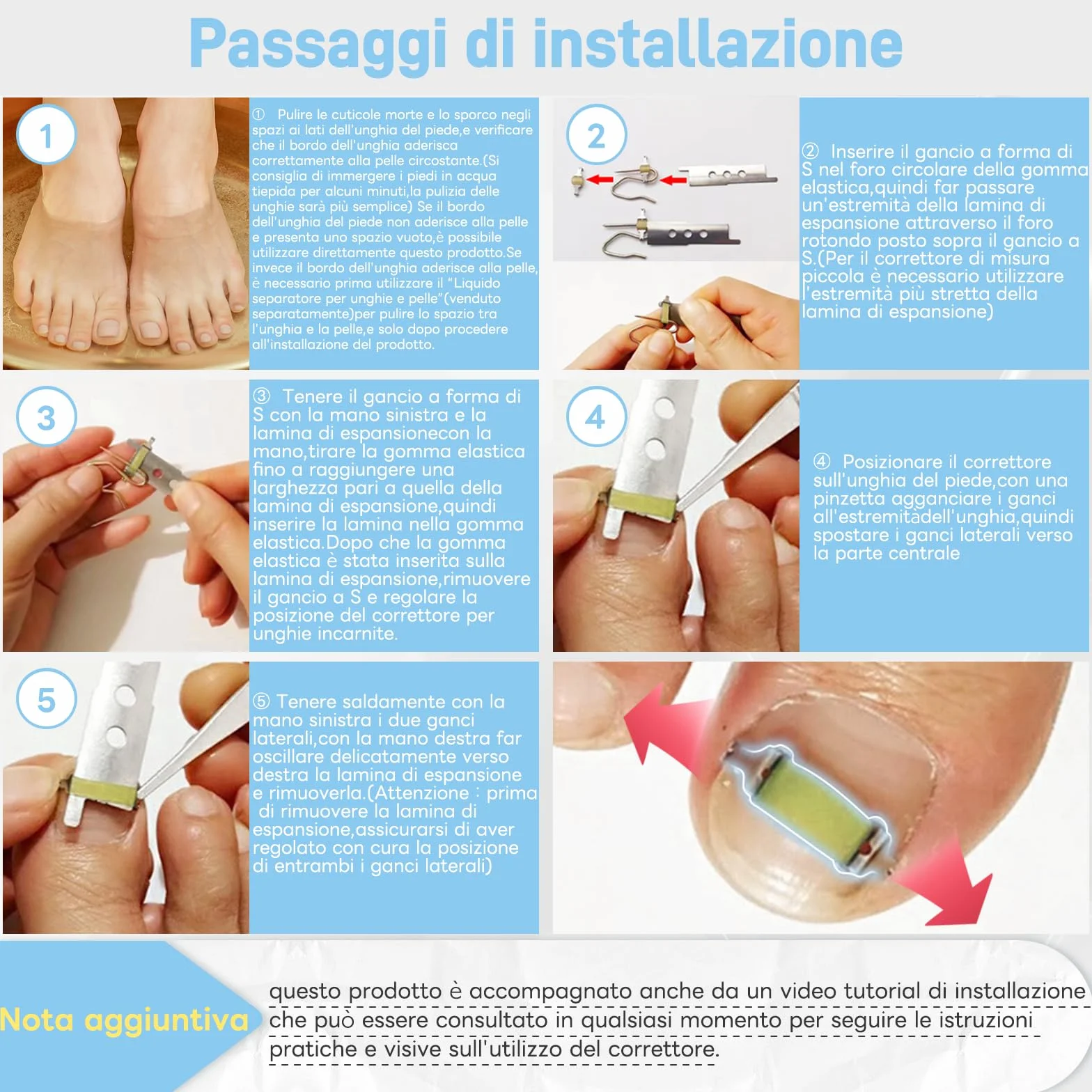 InhwRior Correttore unghie incarnite 19mm-21mm impermeabile doccia