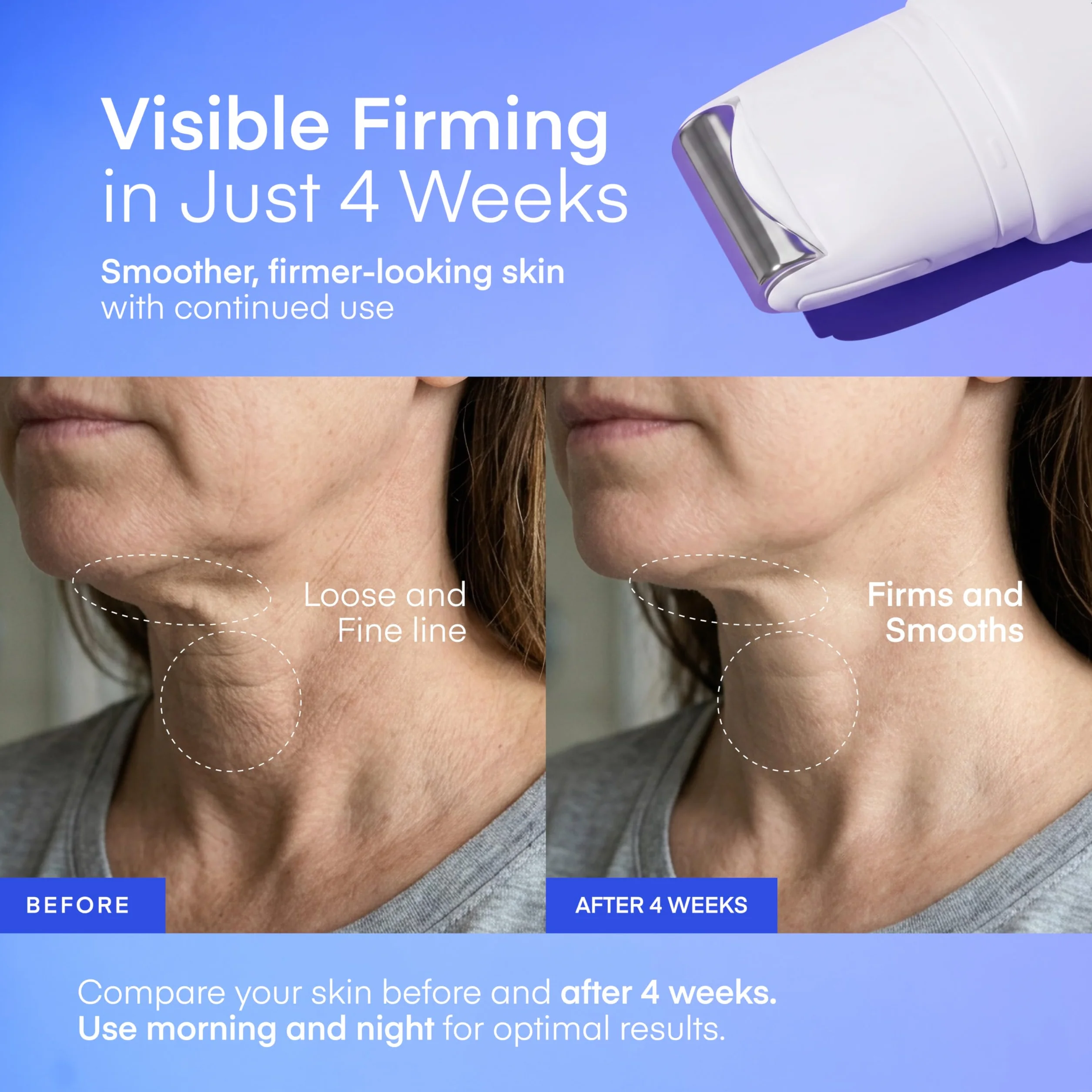 TEREZ & HONOR Gua Sha Neck Firming Cream: Korean Skin Care, Retinol, Collagen & GHK-CU Copper Peptide - Tightening & Lifting for Neck, Face & Décolleté with Built-In Massage Roller 50mL