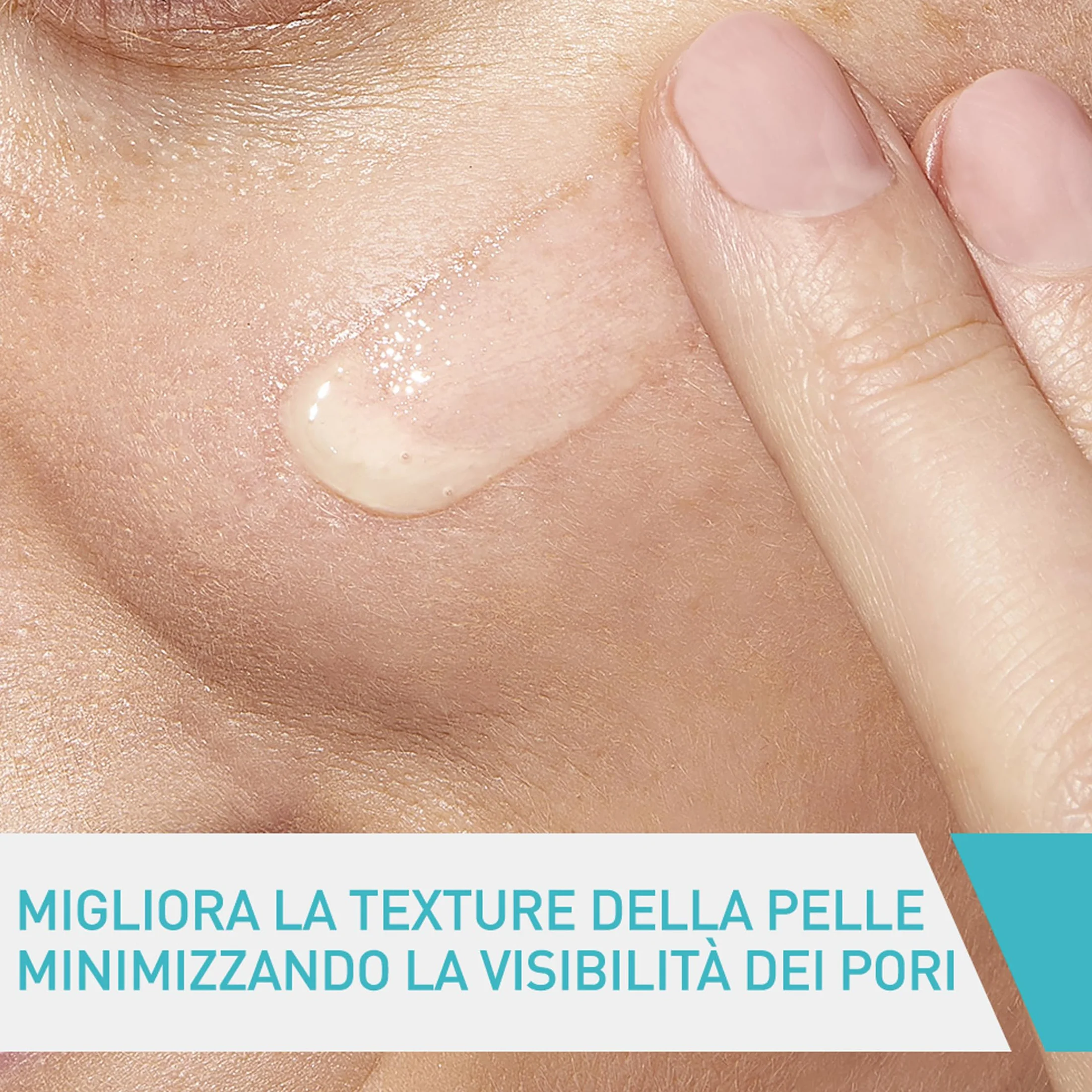 CeraVe Siero Anti-Segni con Retinolo, Per Segni Post-Imperfezioni e Pori Dilatati, Pelle Morbida e Levigata, Con Retinolo Incapsulato, Acido Ialuronico, Liquirizia, Ceramidi e Niacinamide, 30 ml