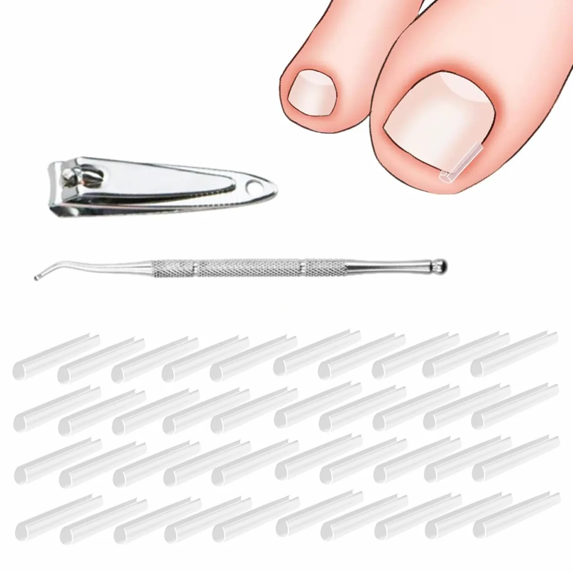 Set correttore per unghie incarnite 40pcs Strisce raddrizzanti per unghie incarnite senza dolore con sollevatore per unghie - Kit di strumenti unghie incarnite facili usare +tagliaunghie