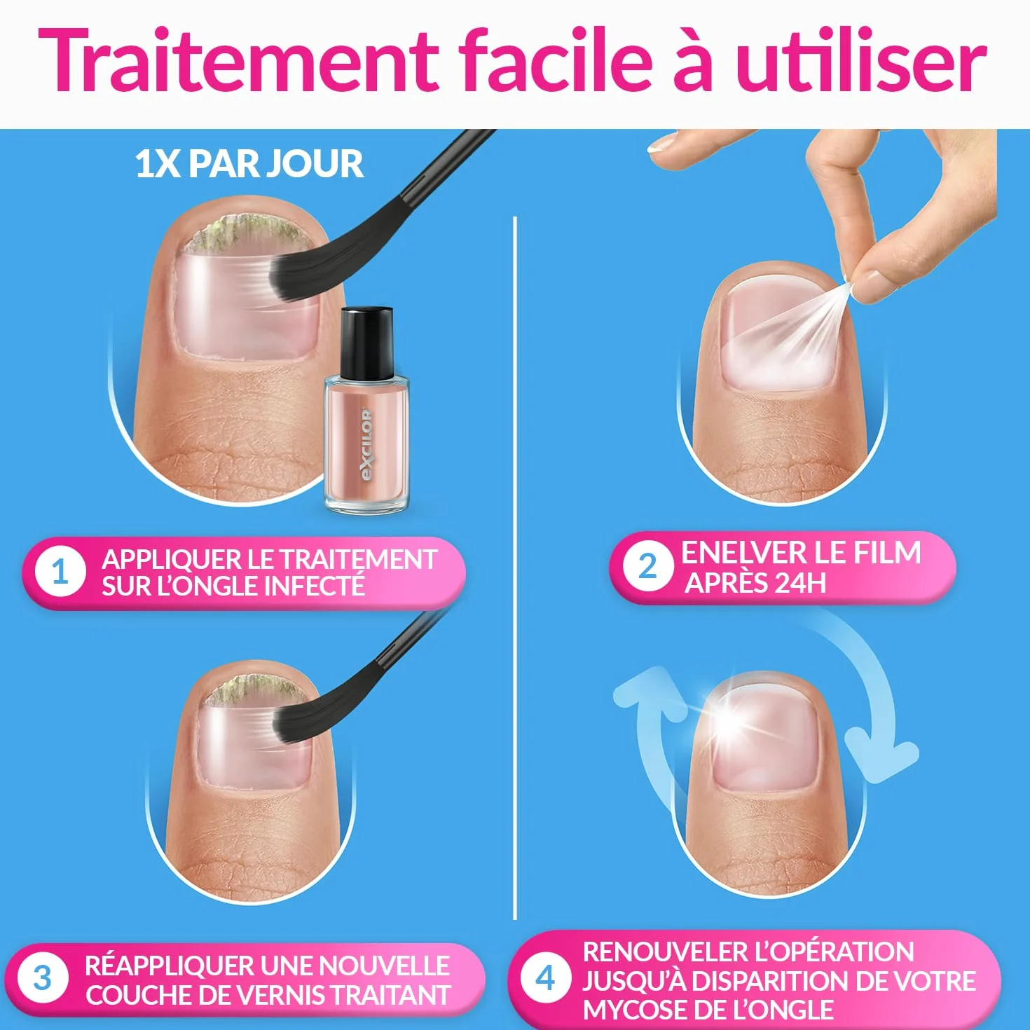 EXCILOR - Forte Color - Trattamento della micosi dell'unghia - Tratta e copre - Trattamento 30 ml + Smalto cosmetico per unghie da 8 ml - Clinicamente provato* - Nude