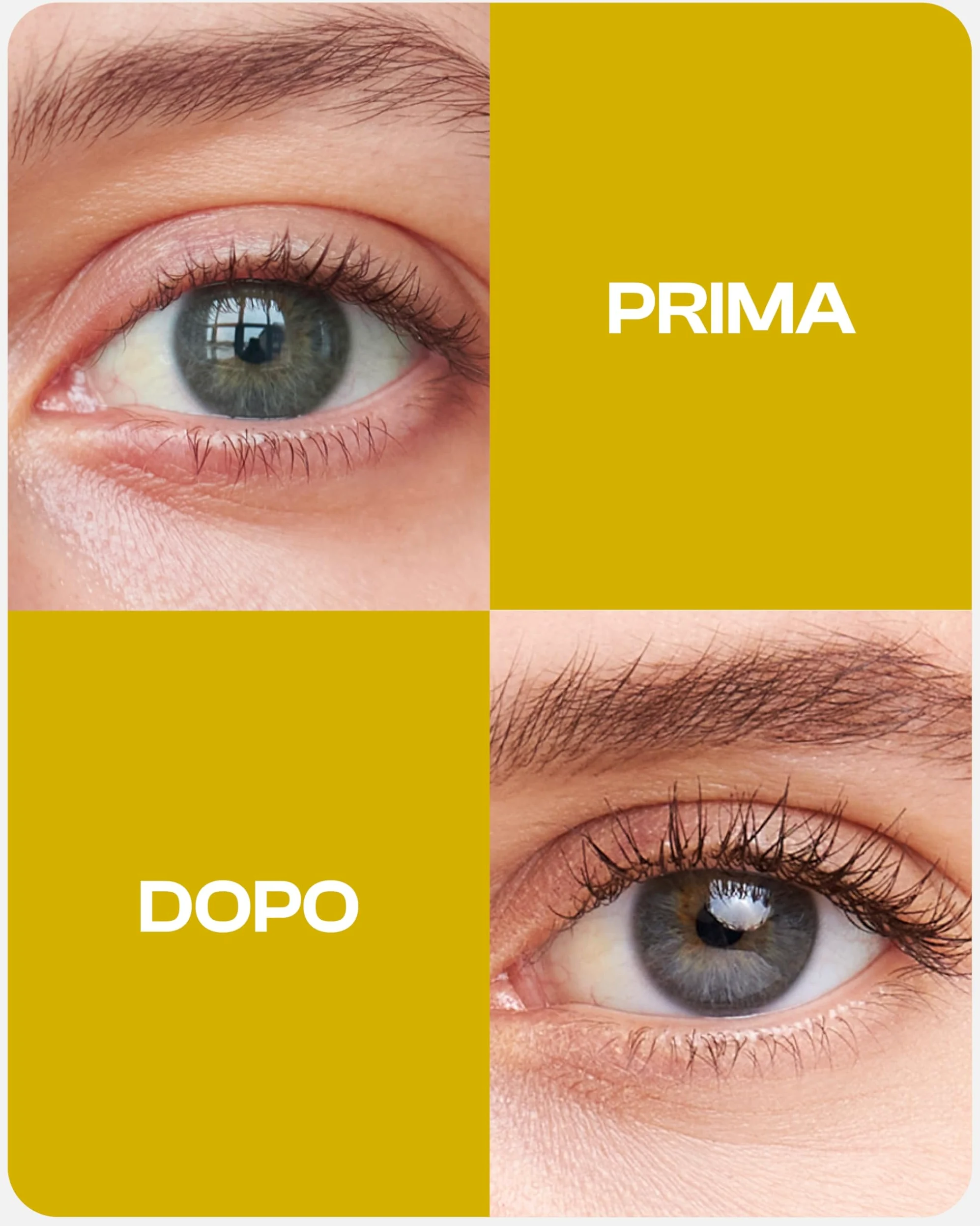 Nutralash Formula Ciglia I Siero per Ciglia Lunghe in Sole 6-8 Settimane I Eyelash Serum I Siero per la Crescita delle Ciglia I Siero per Allungamento Ciglia I Prodotto in Germania I 3ml