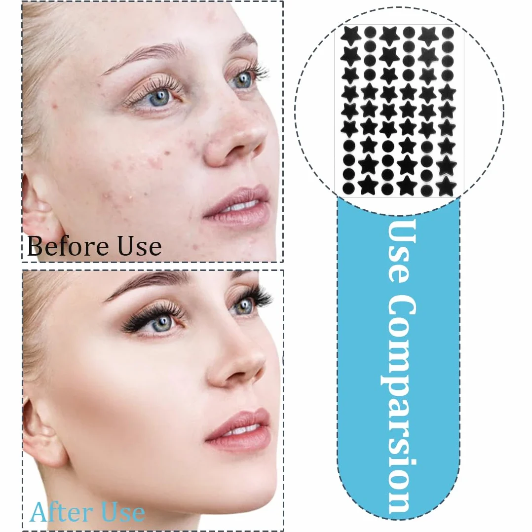 Strisce per punti neri e impurità,720 cerotti per l'acne, adesivi per il trattamento dell'acne per feste di trucco