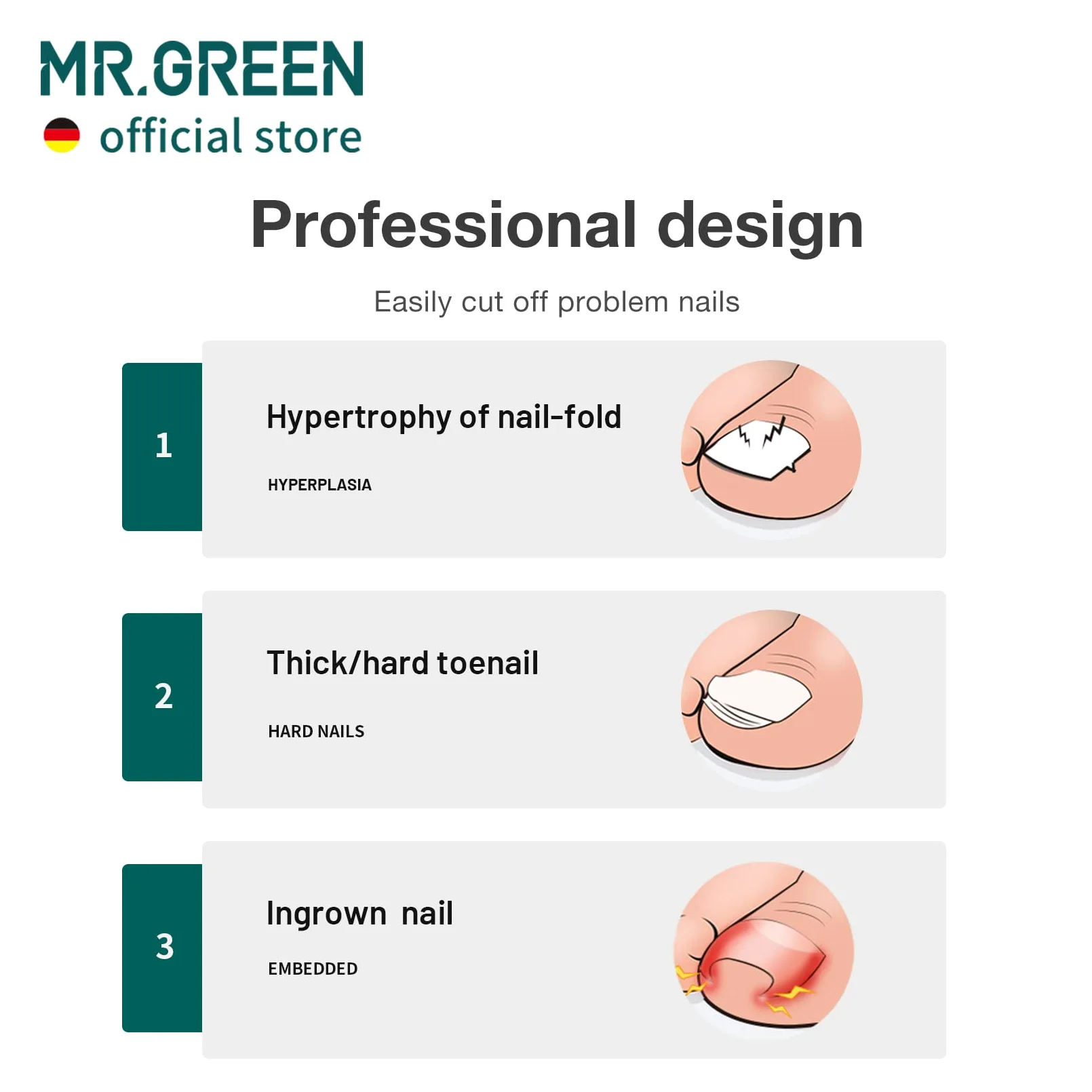 MR.GREEN Tagliaunghie in acciaio inox per unghie incarnite spesse e dure, strumenti per manicure (arancione+rimozione unghie)