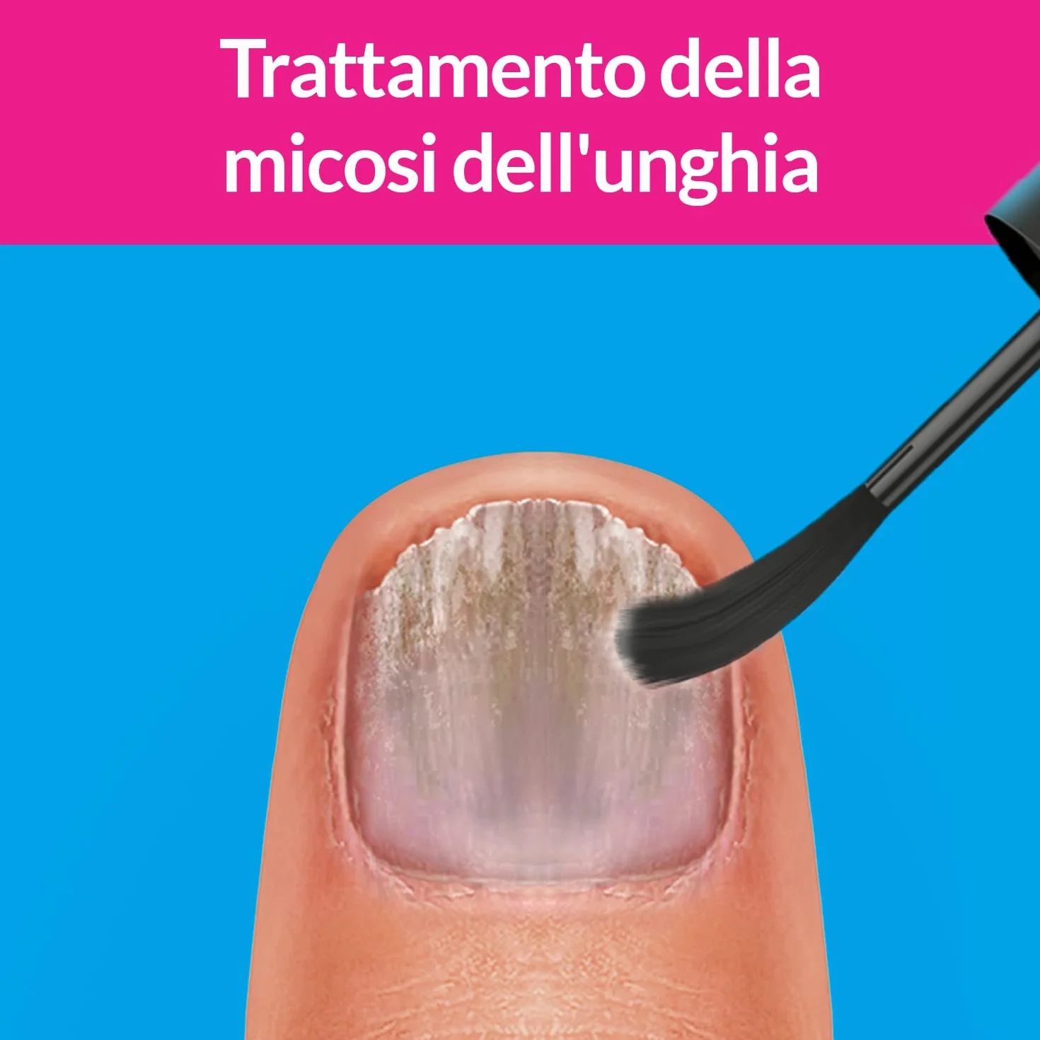 Excilor Micosi dell’unghia Forte, Trattamento Micosi Unghia Attivo, 30 ml