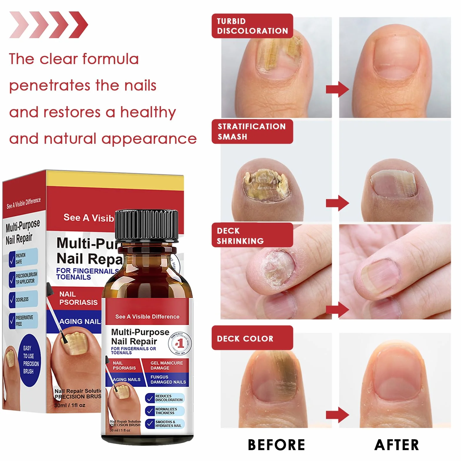 30ml Riparazione Unghie,Soluzione per la Cura delle Unghie,Liquido Cura unghia,per Migliorare l'Aspetto delle Unghies e Rinforzare la Struttura dell'Unghia,Uso Quotidiano
