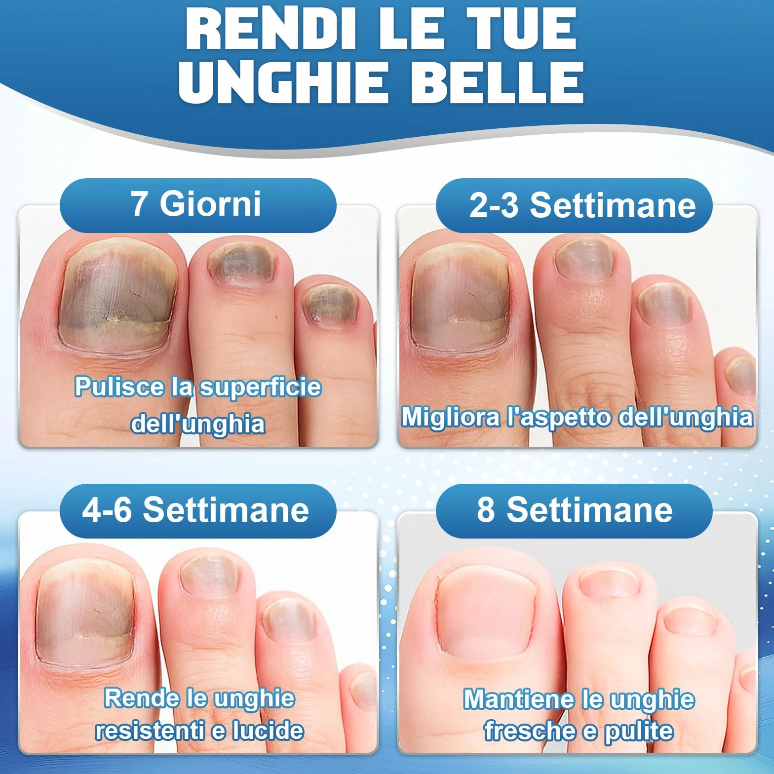 Micosi Unghie Piede, 30ml Liquido Antimicotico per Funghi Unghie Piedi con Pennello e Lima