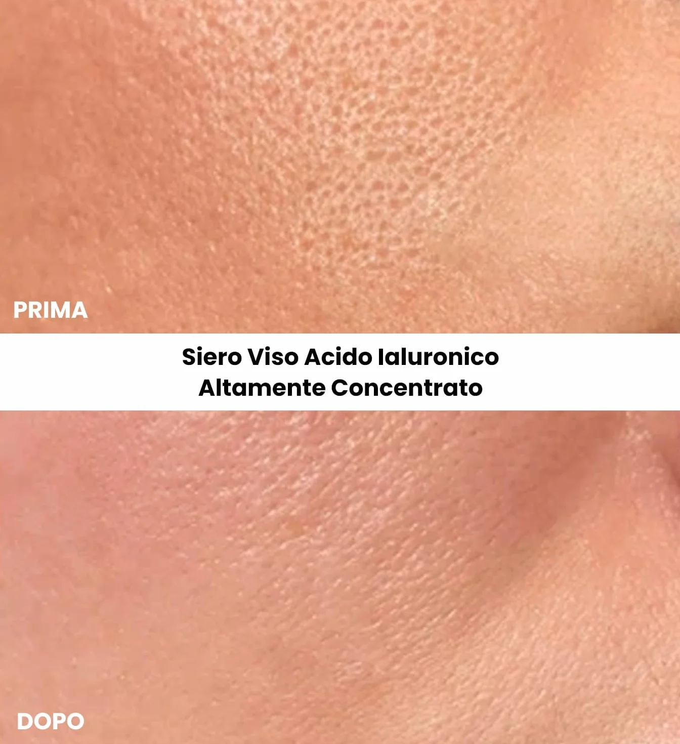 Kleem Siero Acido Ialuronico Viso 1.8% Antirughe Idratazione 24H Bio Vegano