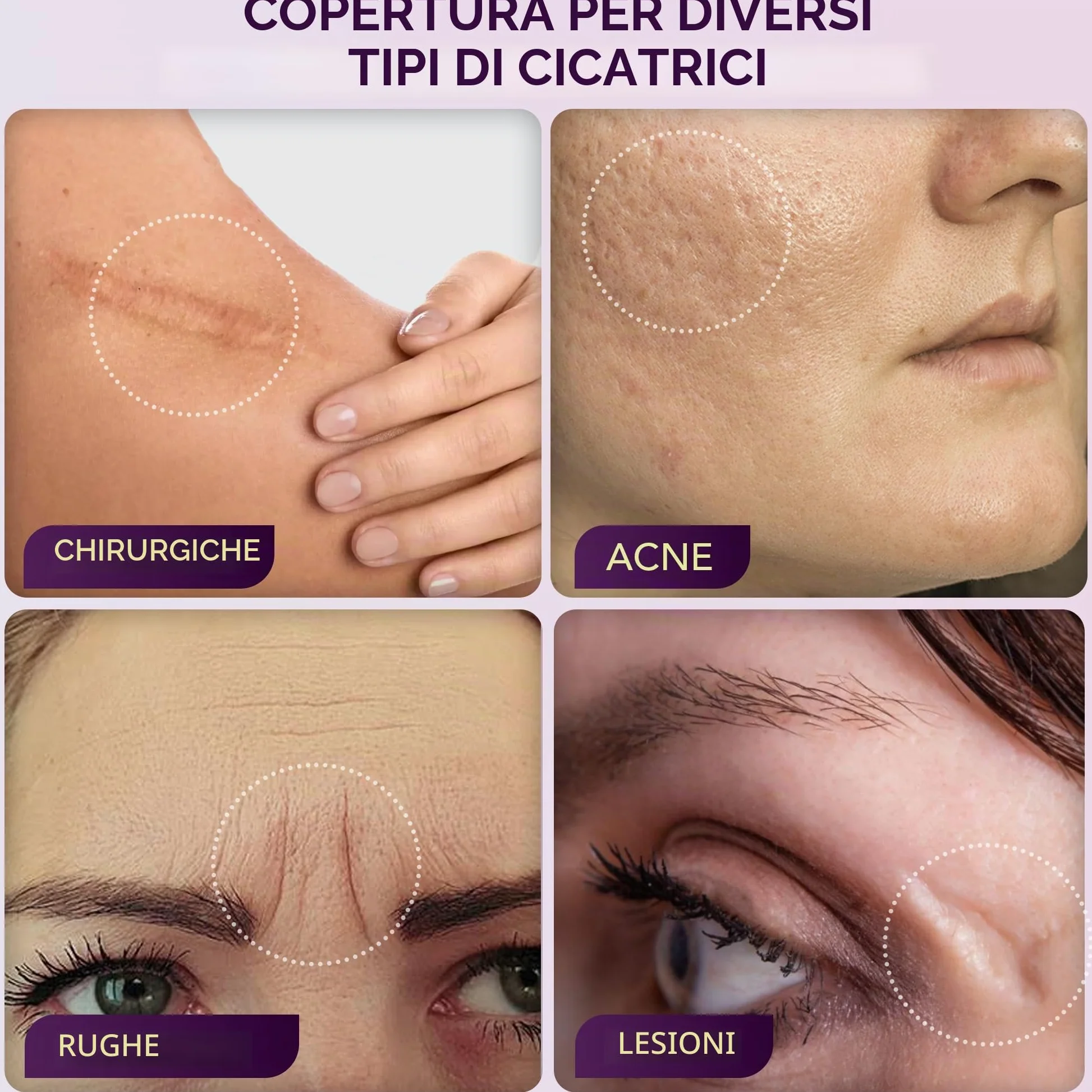 Dermaflage Cover Up – il correttore per cicatrici e linee d’espressione usato dai professionisti di Hollywood